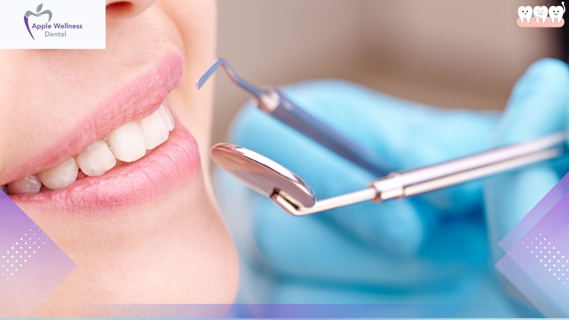 Is Teeth Whitening Safe for Sensitive Teeth in Airdrie? Expert Guide - Apple Wellness Dental