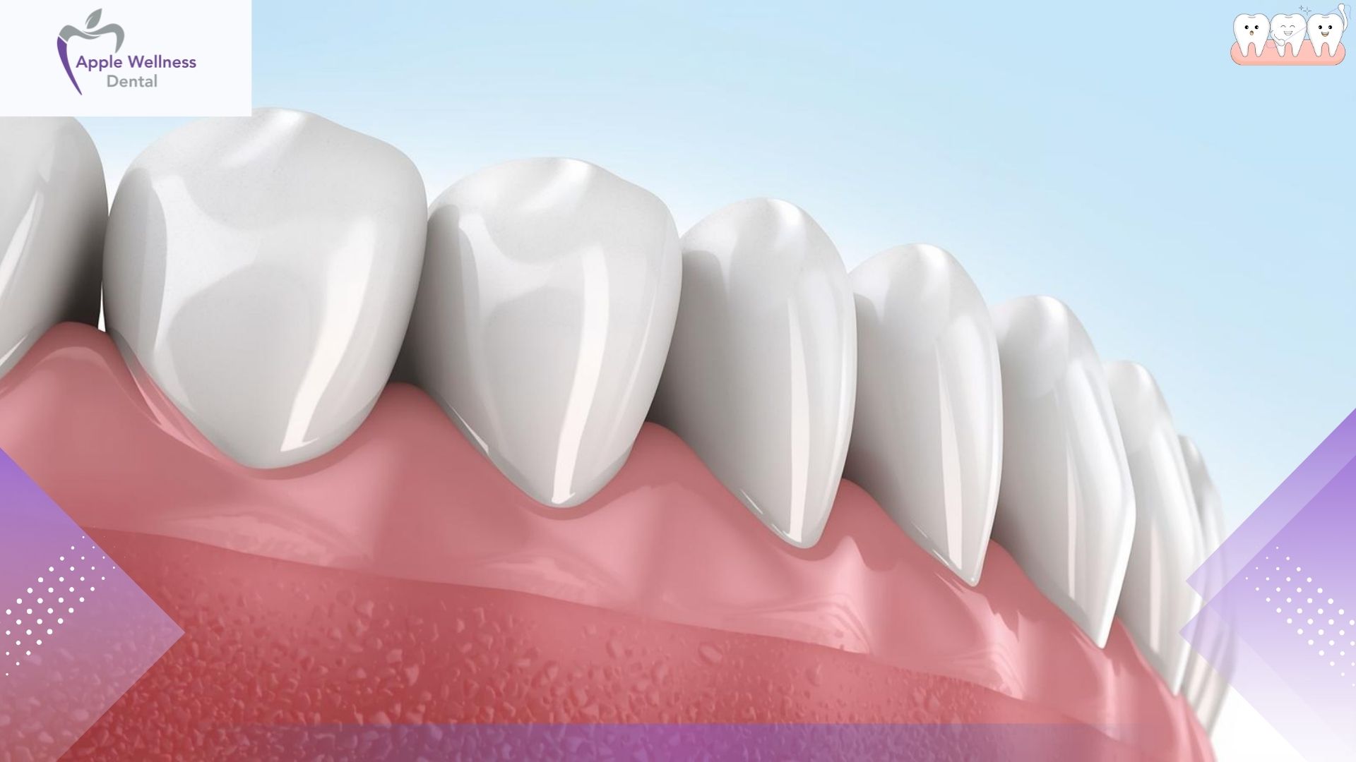 Making Your Restorations Last: What Airdrie Patients Need to Know About Crown Longevity - Apple Wellness Dental