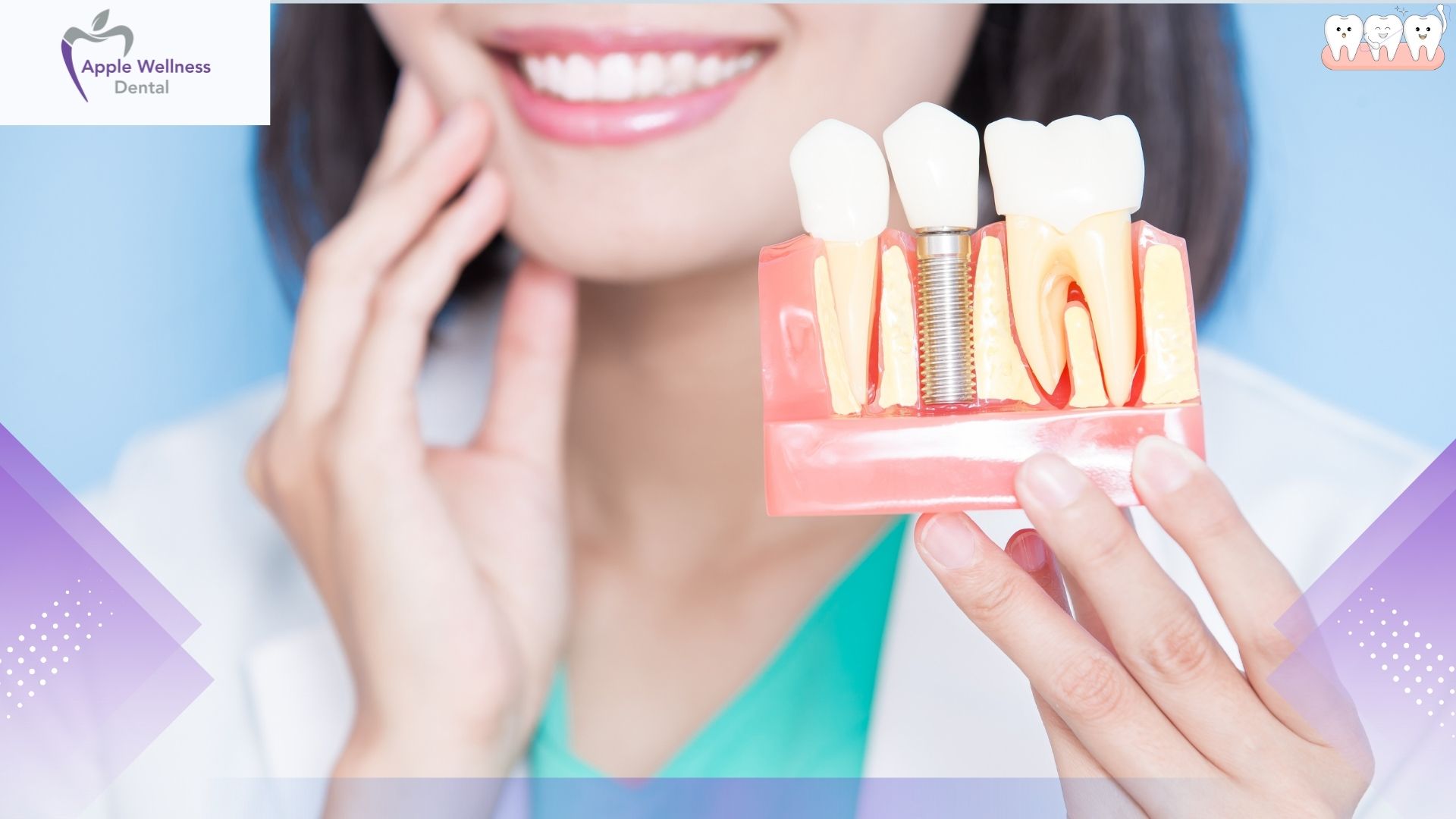 The Truth About Dental Implant Longevity in Airdrie: Are They Permanent? - Apple Wellness Dental