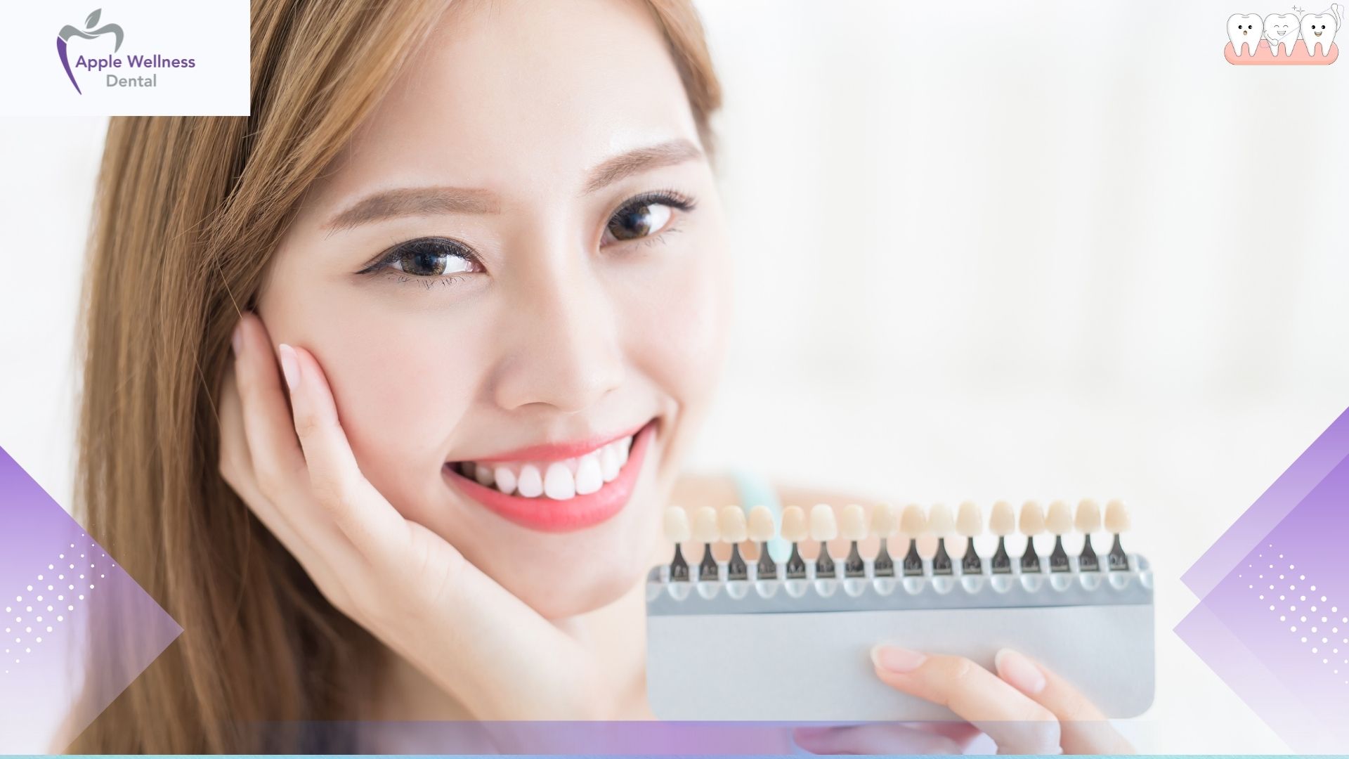 How Does Professional Teeth Whitening Work - Apple Wellness Dental