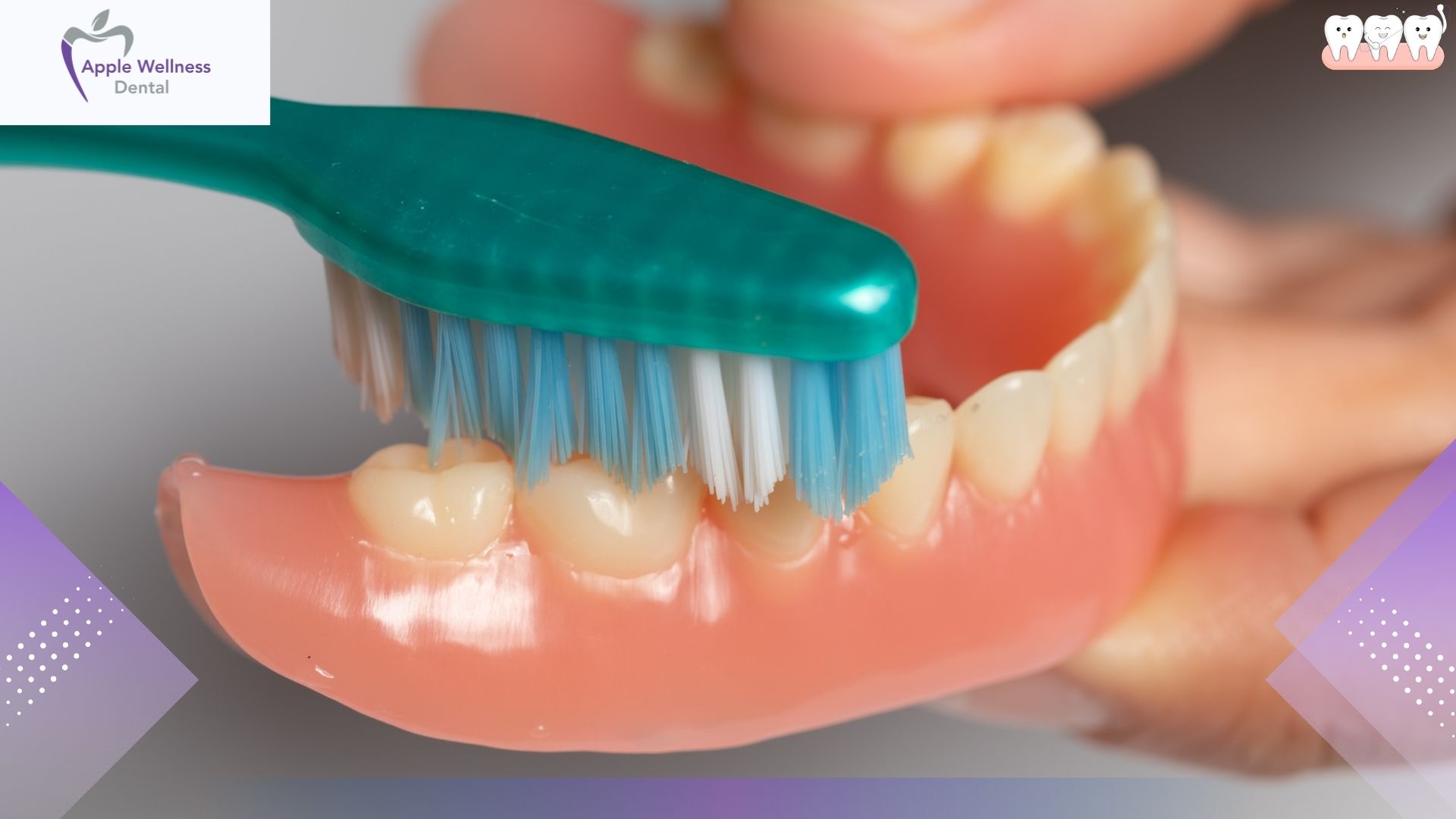 What Is The Difference Between Partial And Full Dentures - Apple Wellness Dental