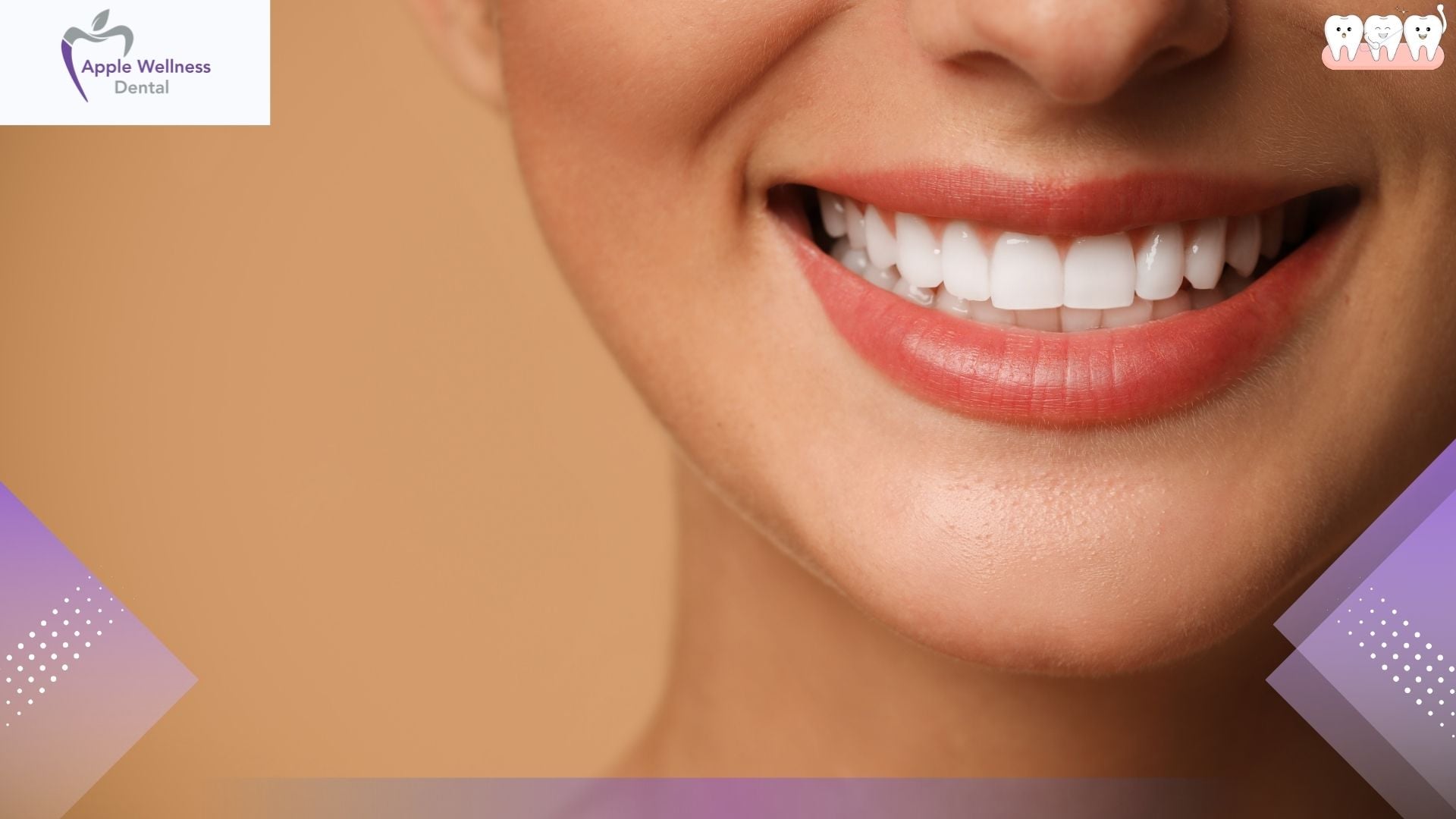 What Are Common Cosmetic Dentistry Treatments in Airdie - Apple Wellness Dental