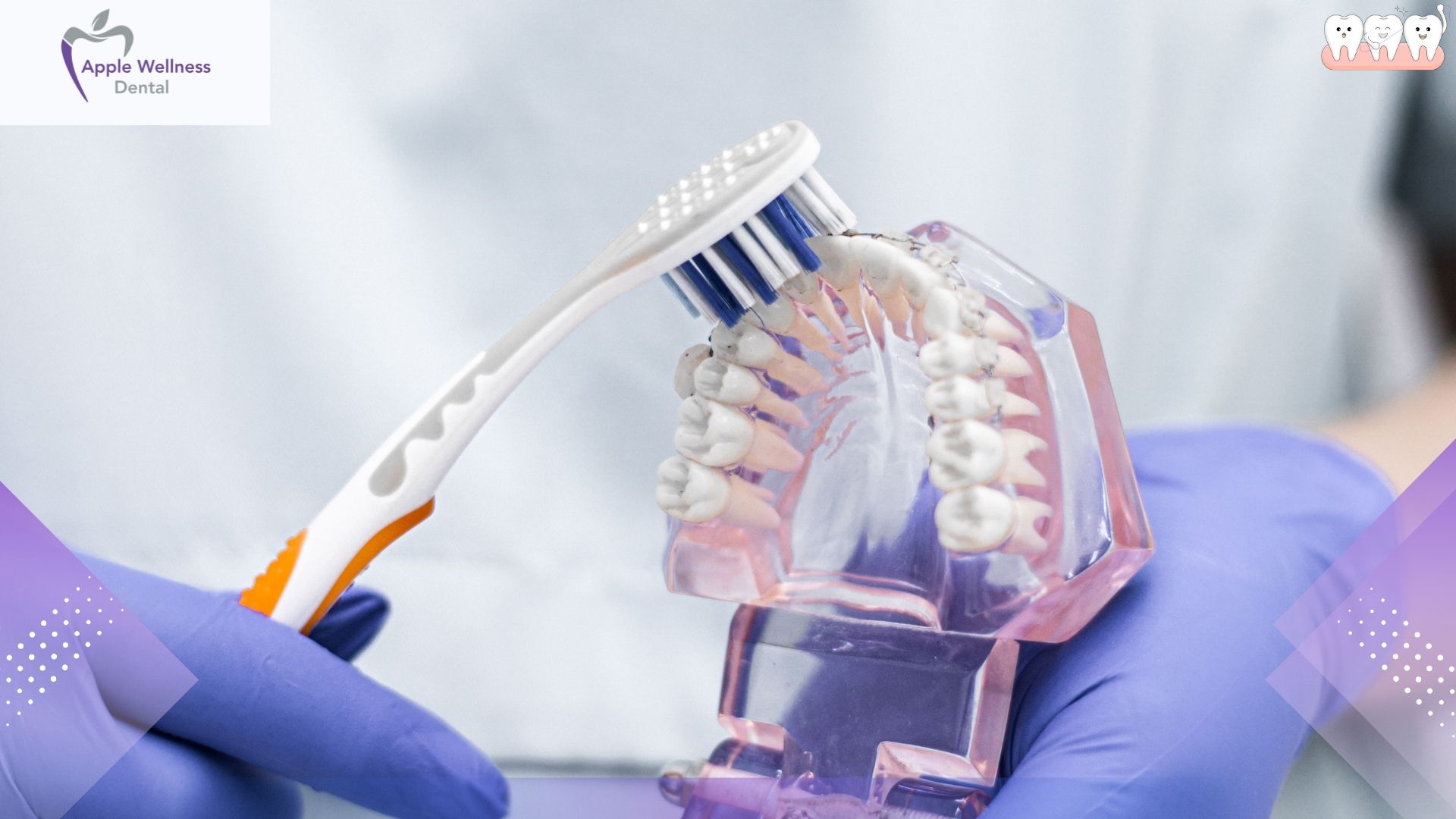 How to Care for Dentures Properly in Airdrie - Apple Wellness Dental