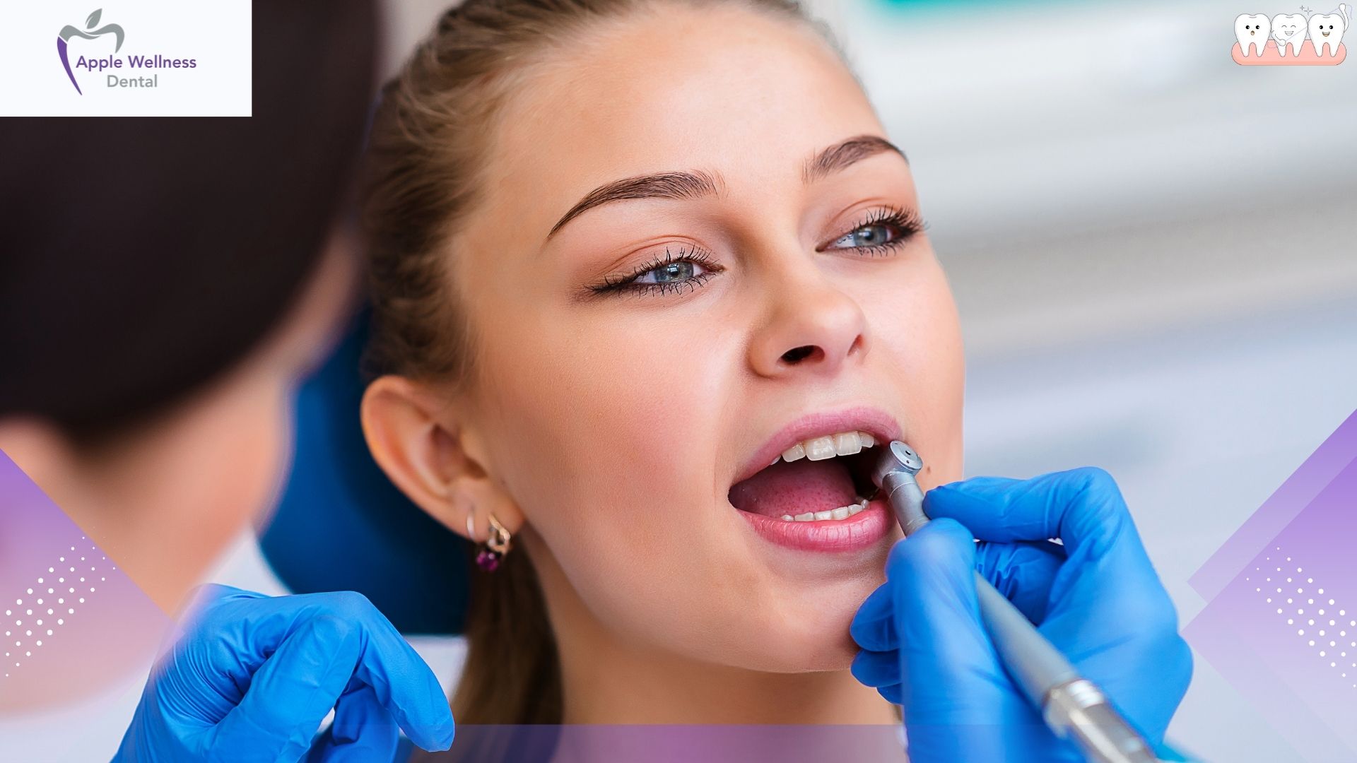 Why Is Restorative Dentistry Important? A Guide to Oral Health - Apple Wellness Dental