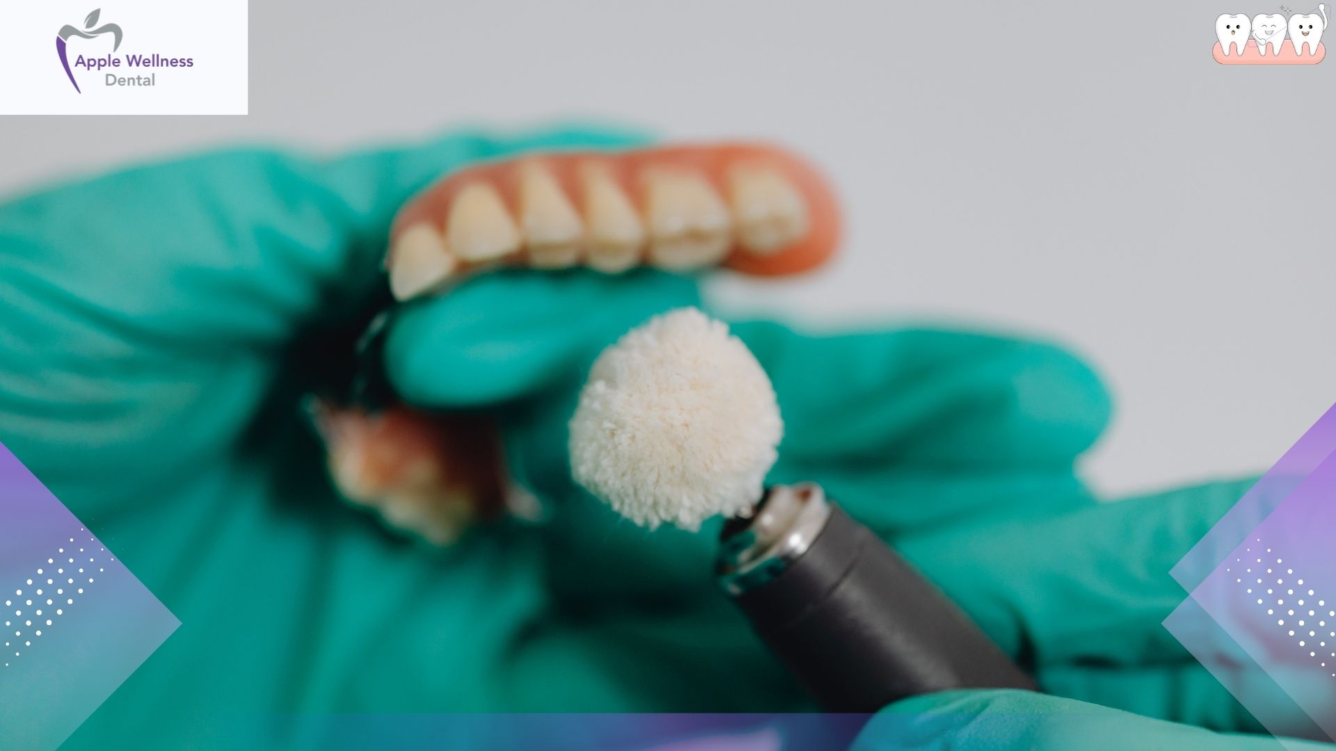 What Are Dentures? A Complete Guide to Restoring Your Smile - Apple Wellness Dental