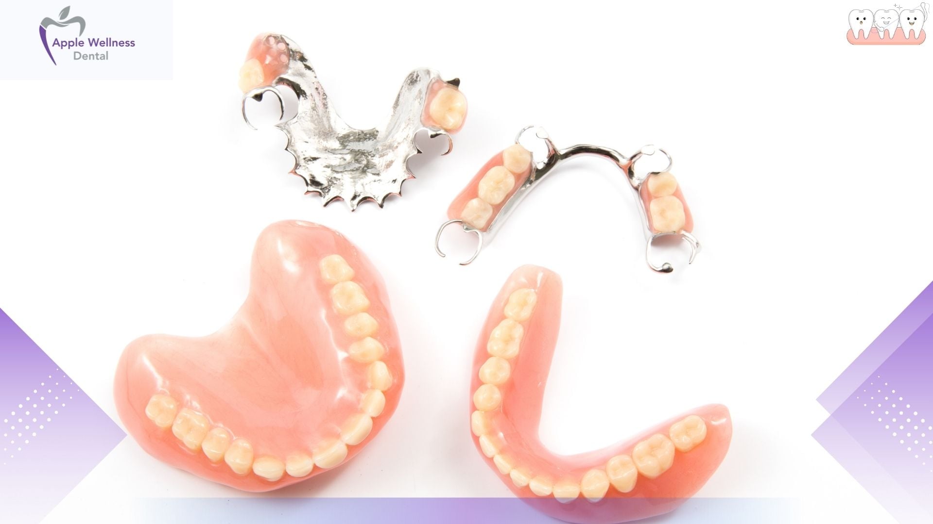 How Long Do Dentures Last? Lifespan & Replacement Guide - Apple Wellness Dental