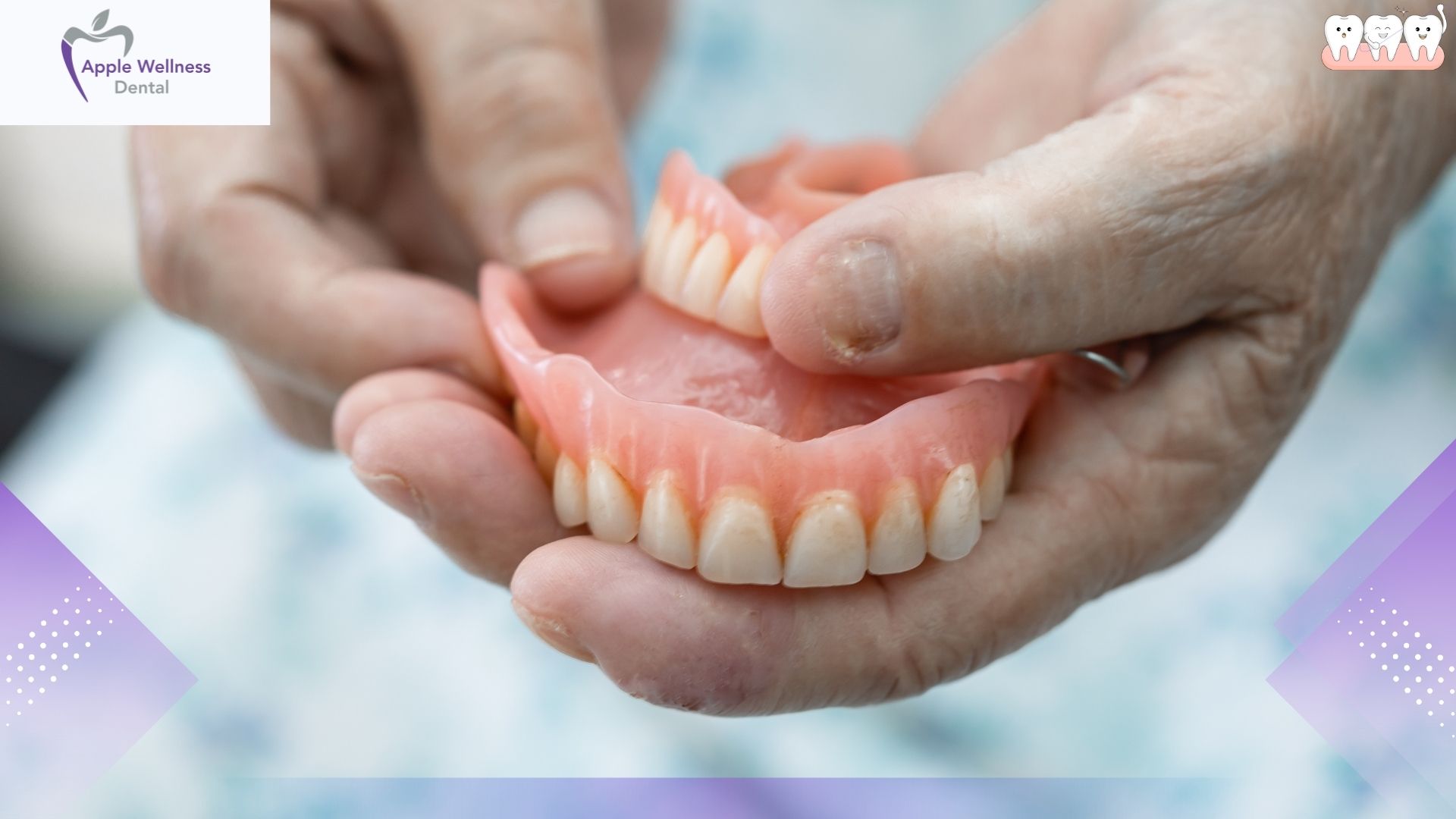 What Is the Difference Between Partial and Full Dentures in Airdrie? A Patient’s Guide - Apple Wellness Dental