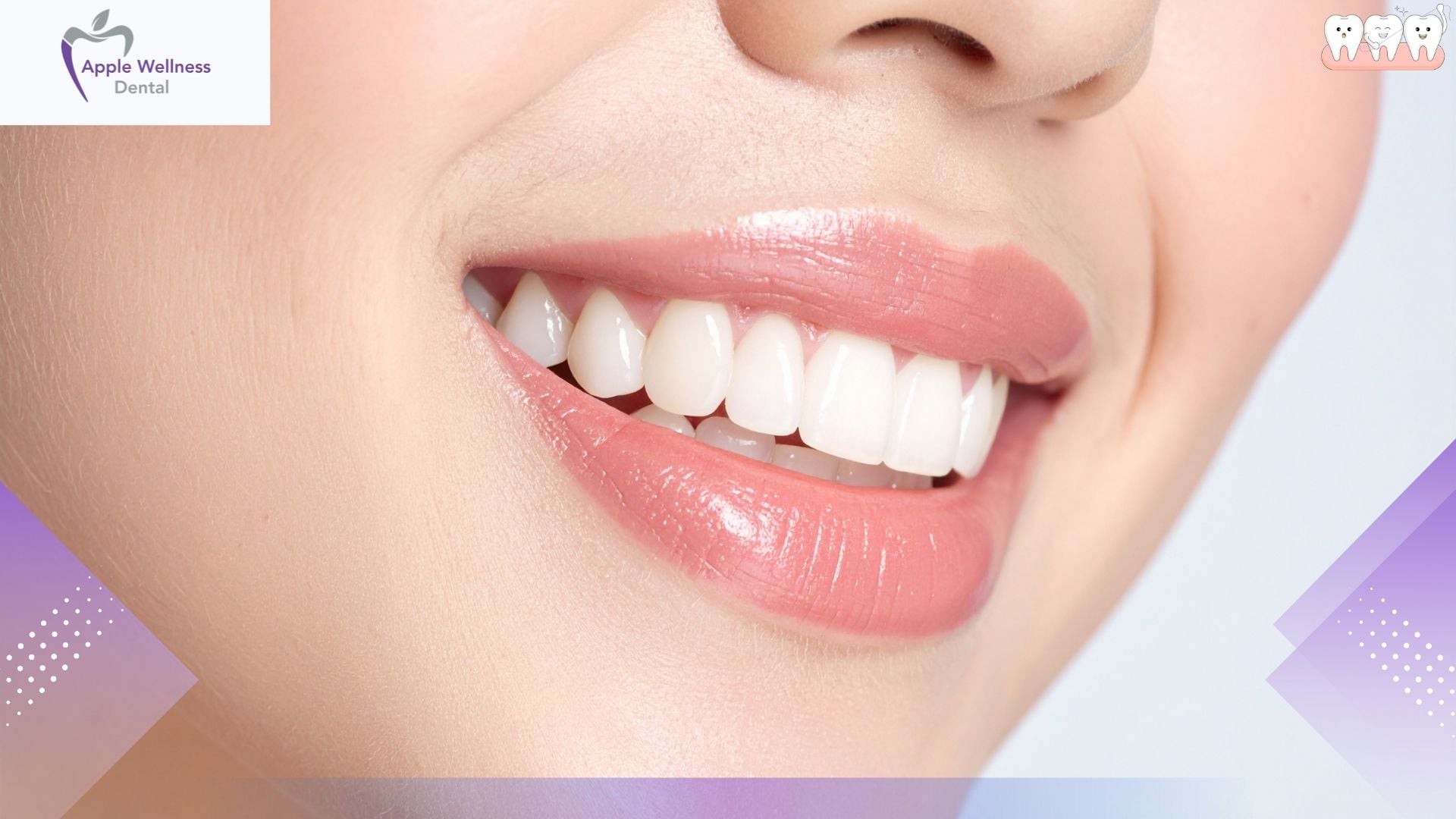 What Are Common Cosmetic Dentistry Treatments in Airdie - Apple Wellness Dental
