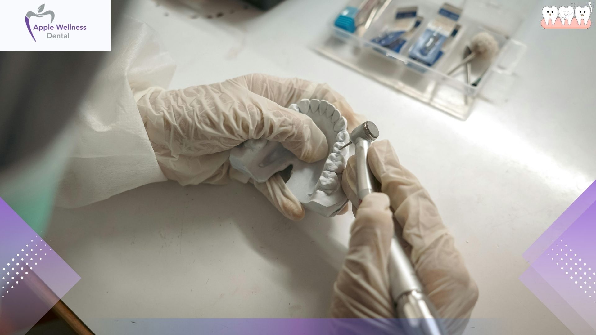 What Are Dentures Made Of? Understanding Your New Smile - Apple Wellness Dental