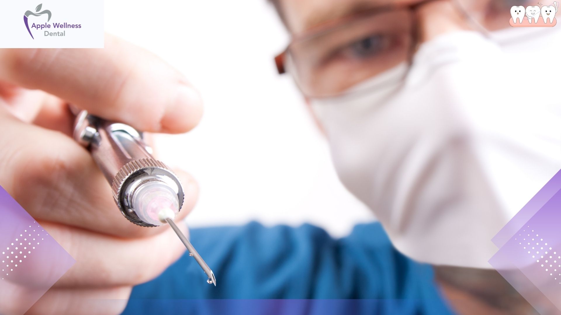 How Long Will You Stay Numb? A Complete Guide to Dental Anesthesia - Apple Wellness Dental