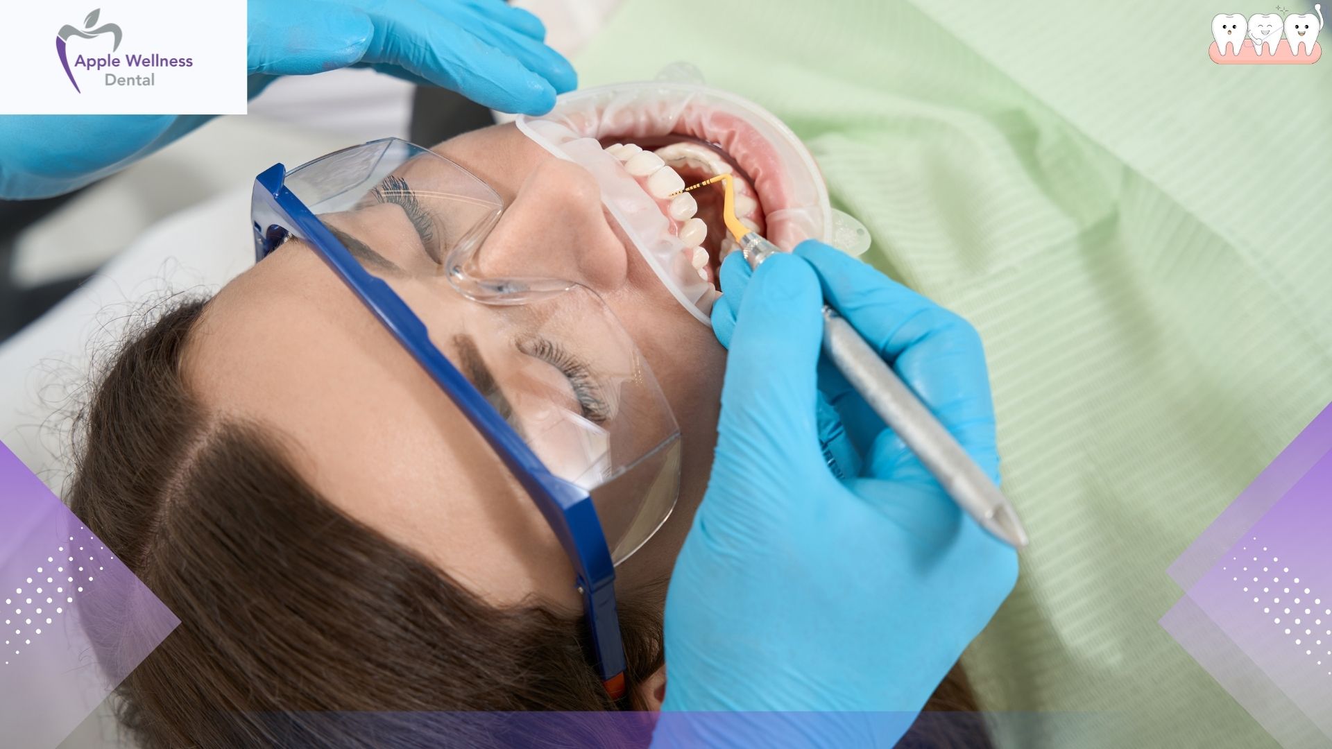 How Painful Is a Teeth Scaling Procedure? What Every Patient Should Know - Apple Wellness Dental How Painful Is a Teeth Scaling Procedure? What Every Patient Should Know - Apple Wellness Dental