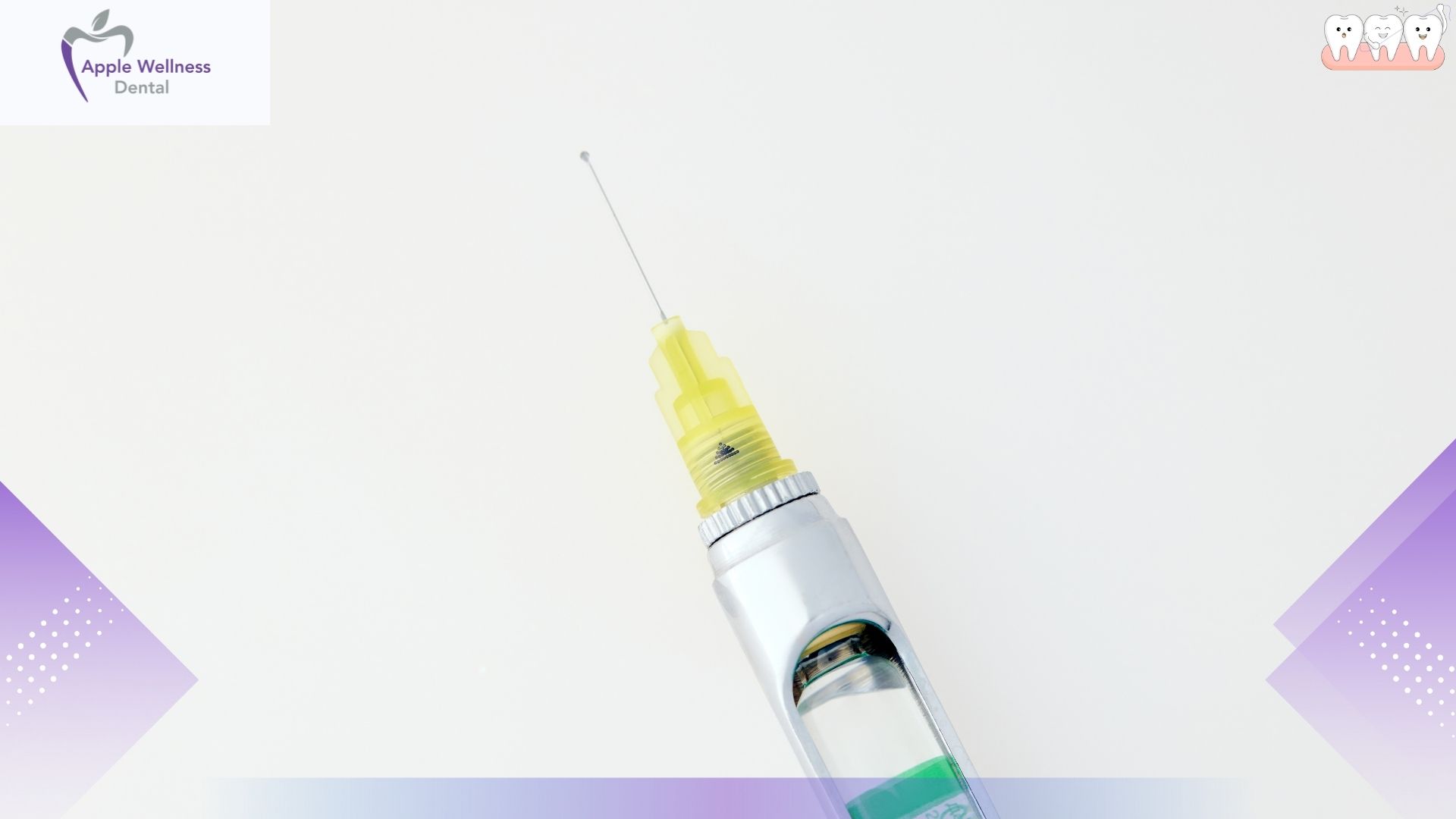 How Long Will You Stay Numb? A Complete Guide to Dental Anesthesia - Apple Wellness Dental