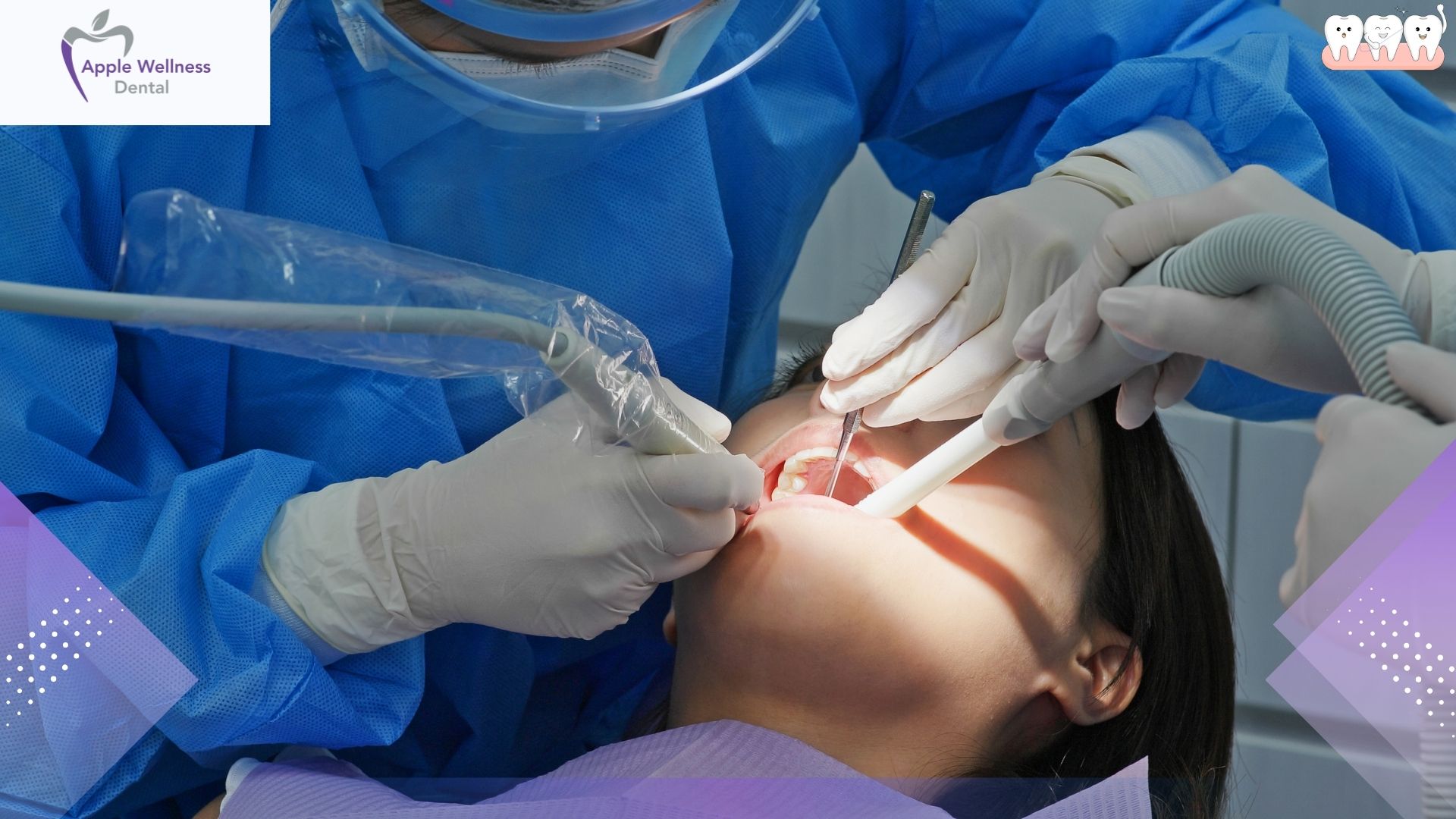How Often Should Scaling Be Done? A Practical Guide for Every Patient - Apple Wellness Dental