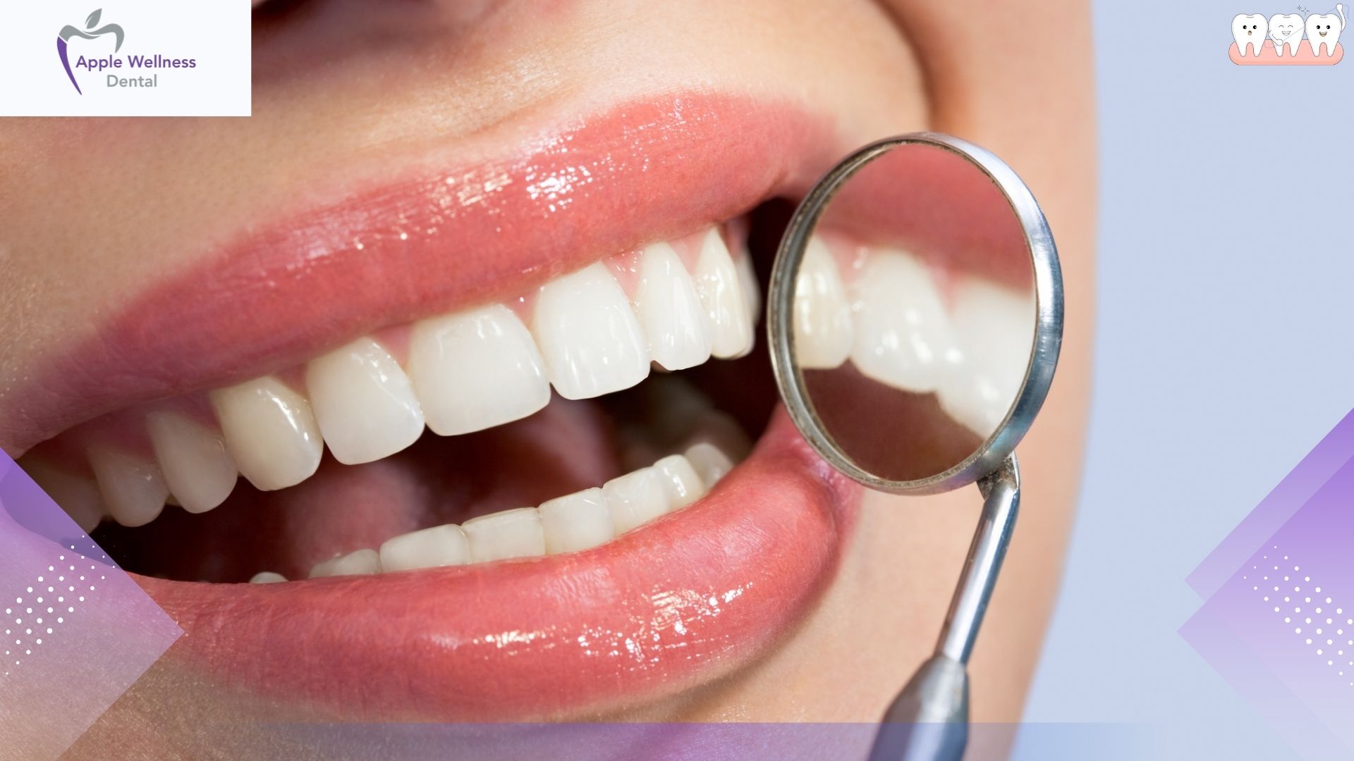 How Painful Is a Teeth Scaling Procedure? What Every Patient Should Know - Apple Wellness Dental How Painful Is a Teeth Scaling Procedure? What Every Patient Should Know - Apple Wellness Dental