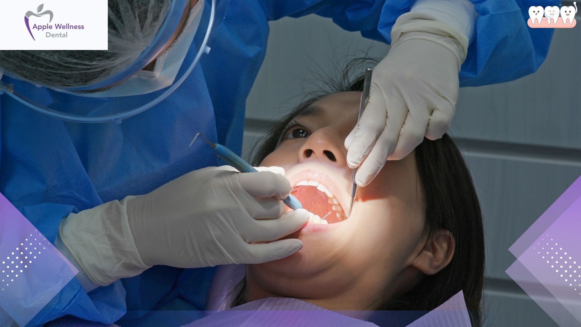 Understanding Dental Freezing Areas: What Gets Numb, How Long It Lasts, and What to Expect - Apple Wellness Dental