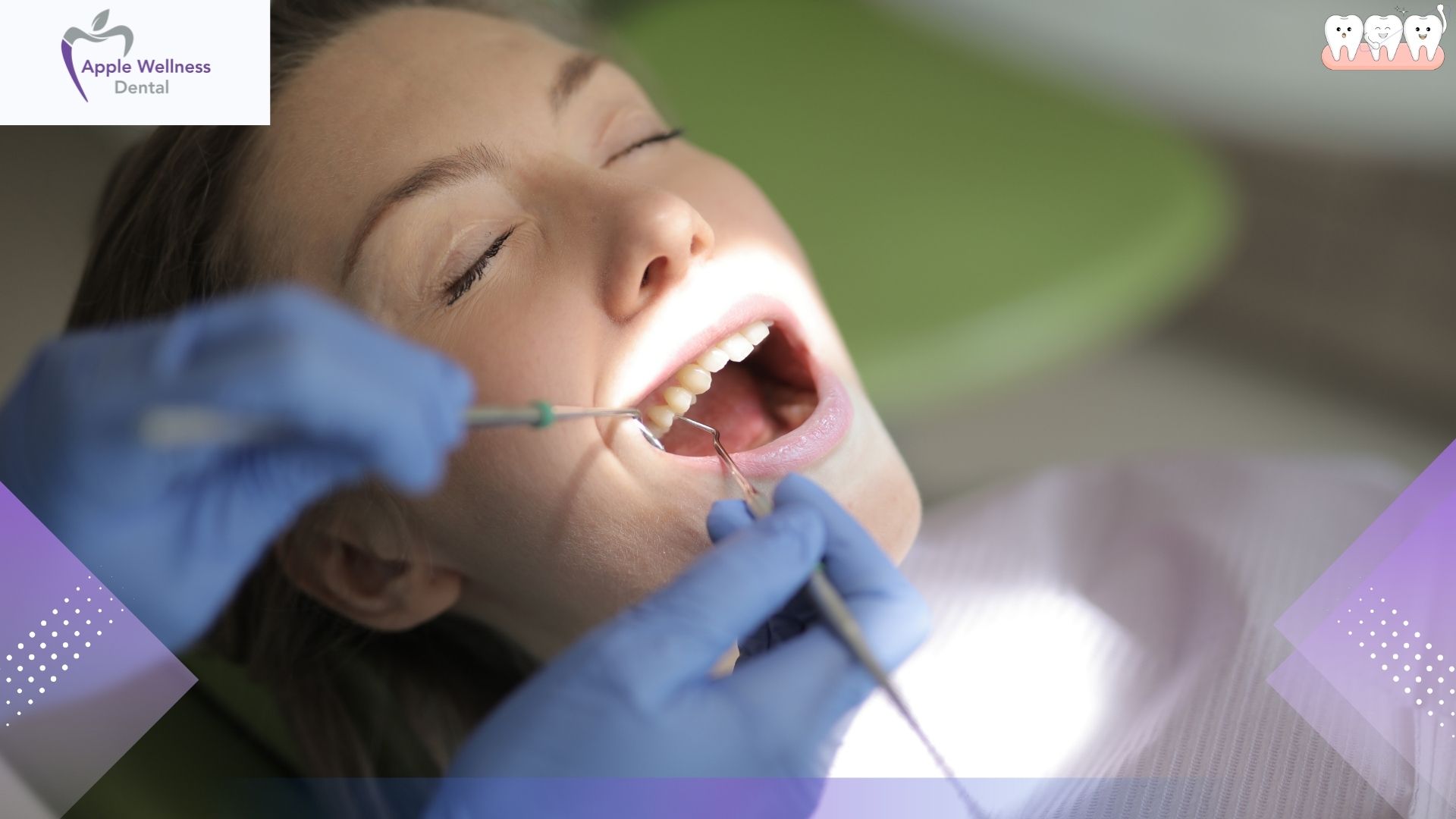 What to Expect From Scaling Dentistry in Airdrie, Alberta - Apple Wellness Dental What to Expect From Scaling Dentistry in Airdrie, Alberta - Apple Wellness Dental