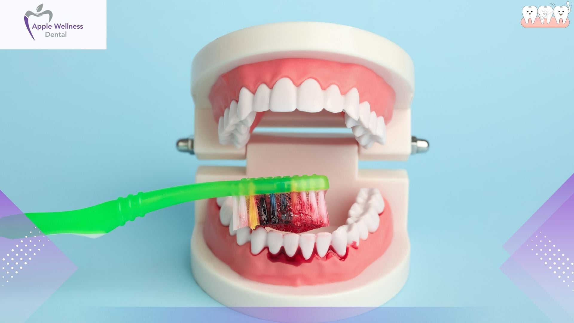 What Happens If Bleeding Doesn't Stop After Tooth Extraction - Apple Wellness Dental