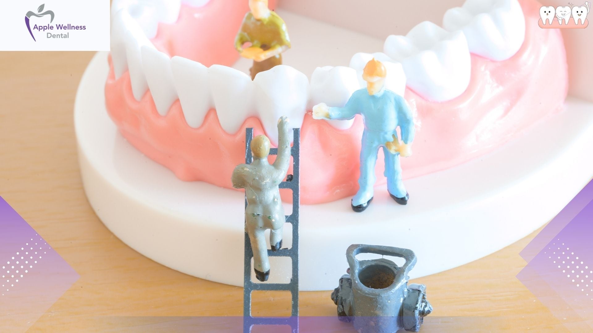 A Cleaner Denture Routine Makes Everyday Life Easier - Apple Wellness Dental
