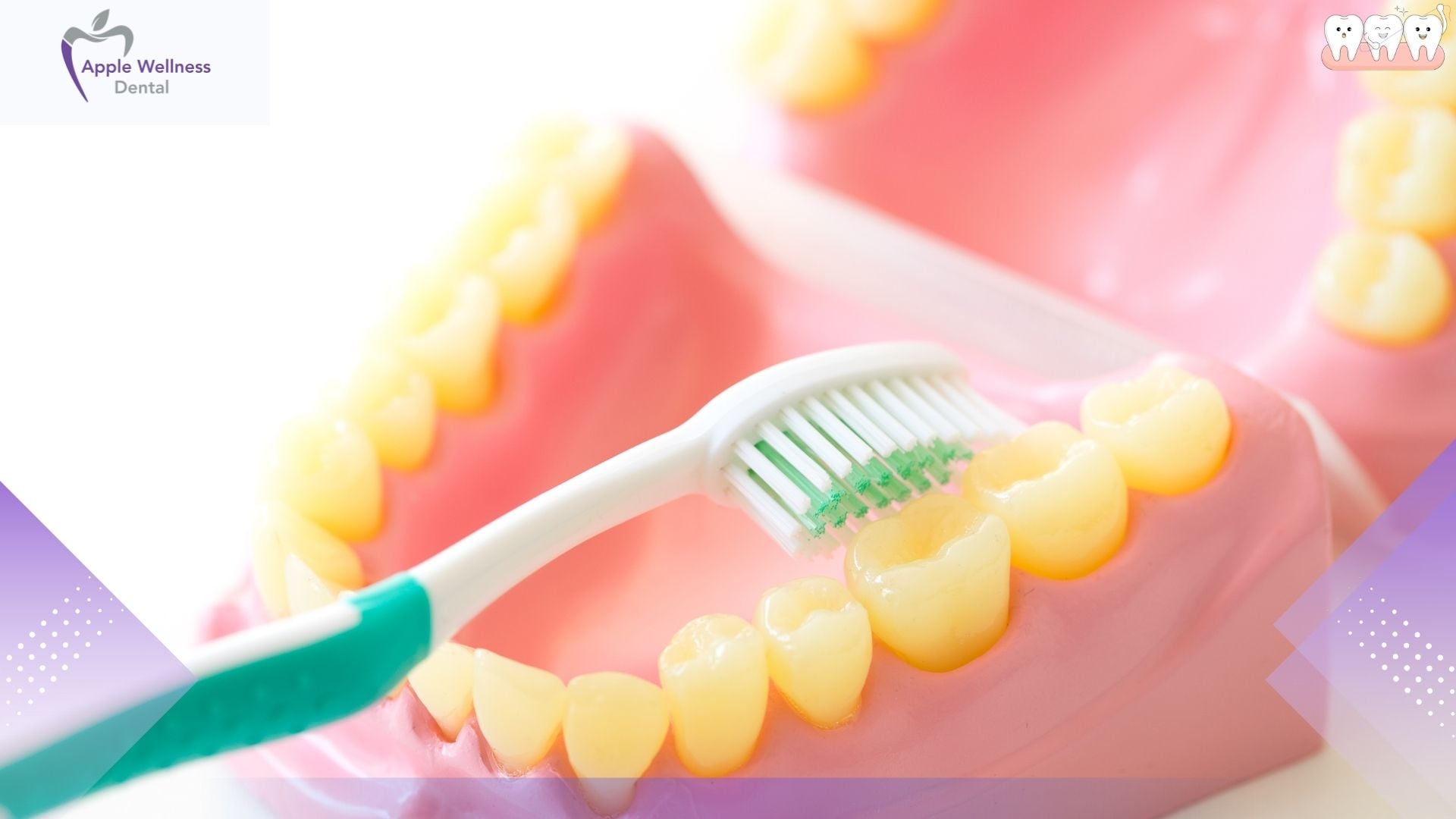 A Cleaner Denture Routine Makes Everyday Life Easier - Apple Wellness Dental