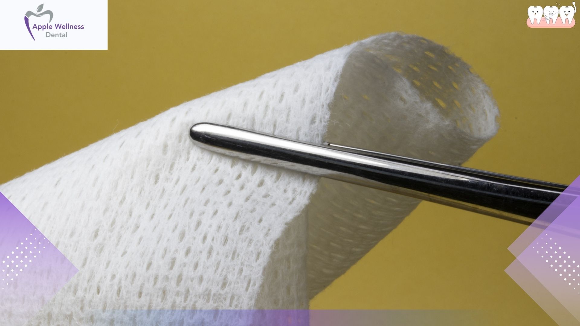 Sleeping with Gauze After Tooth Extraction: What Every Patient Must Know for Safe Healing - Apple Wellness Dental