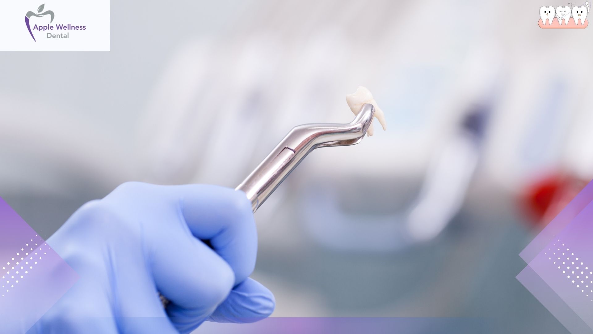 Vaping After Tooth Extraction: The Complete Healing & Risk Guide - Apple Wellness Dental
