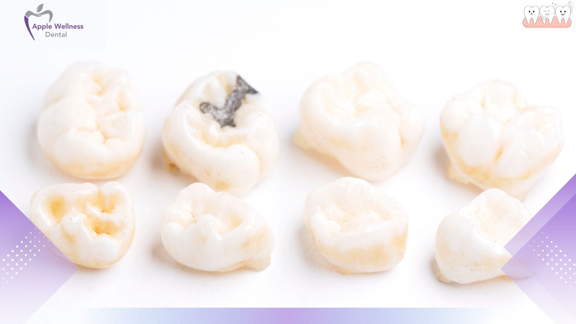 What Are Primary and Permanent Teeth - Apple Wellness Dental