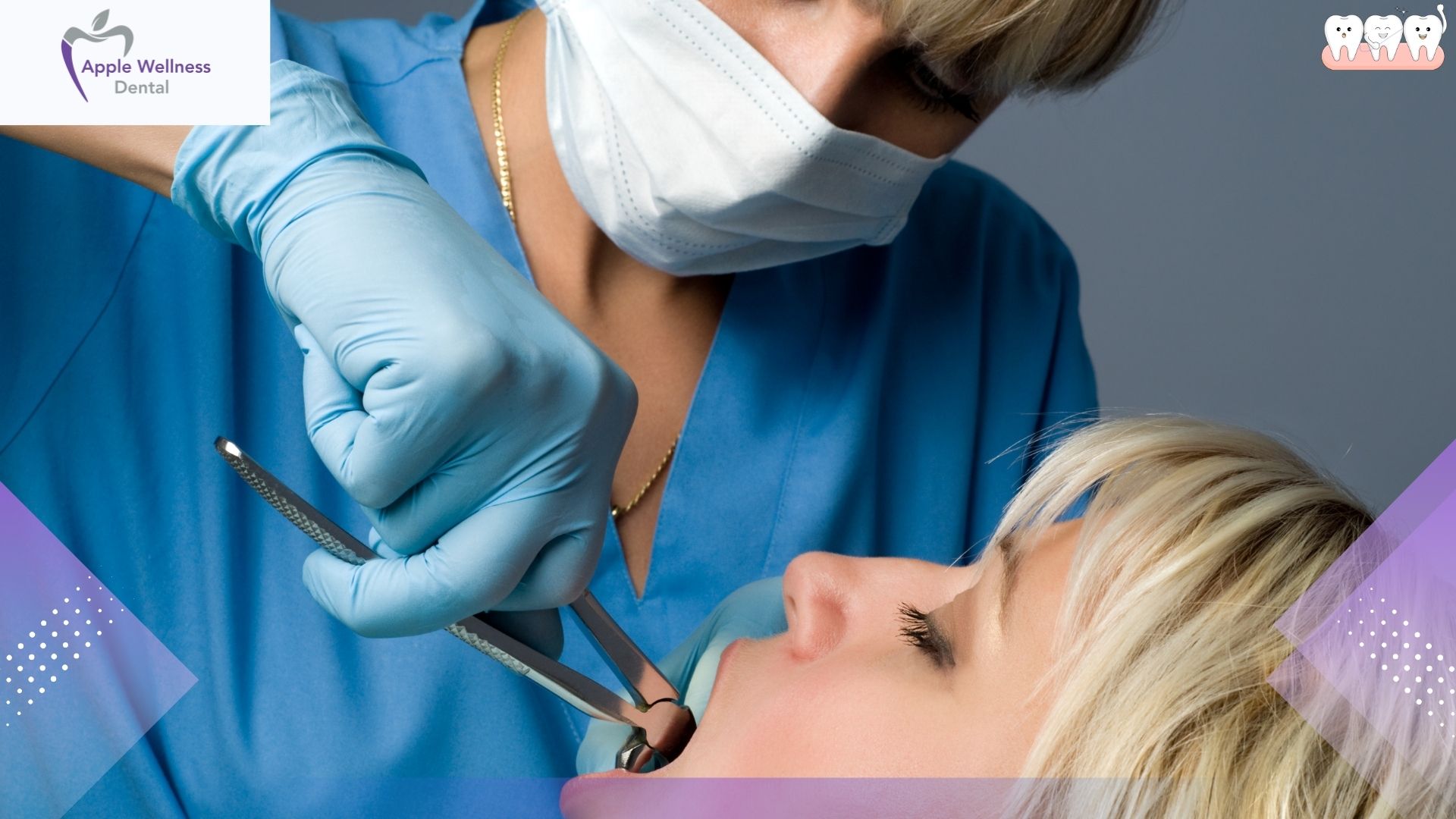 Is It Safe to Drink Alcohol 5 Days After a Tooth Extraction? A Complete Healing Guide - Apple Wellness Dental