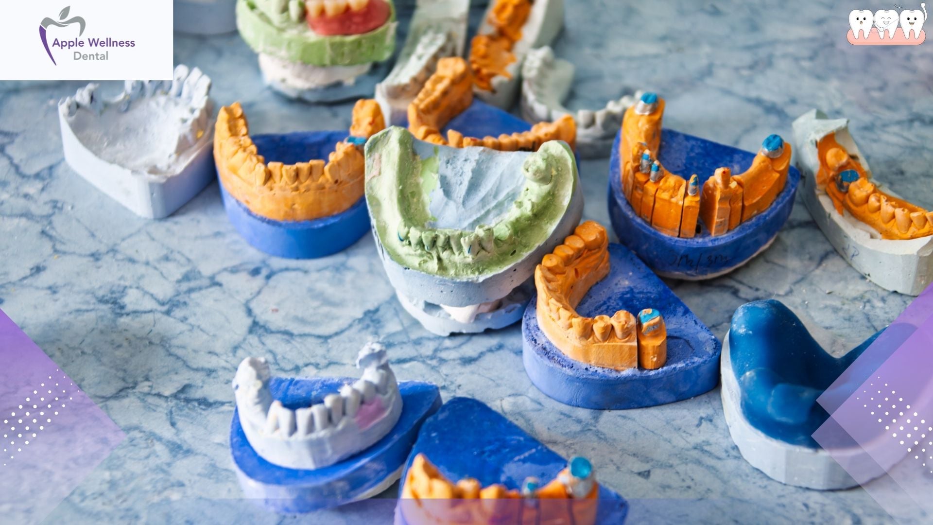Restorative Dentistry in Airdrie, AB: Rebuild Your Smile at Apple Wellness Dental - Apple Wellness Dental Restorative Dentistry in Airdrie, AB: Rebuild Your Smile at Apple Wellness Dental - Apple Wellness Dental