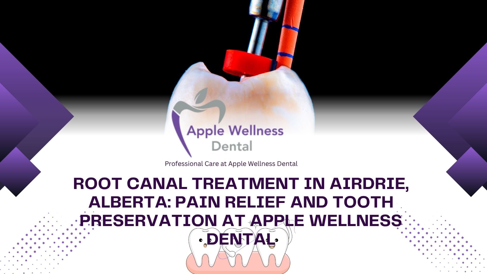 Root Canal Treatment in Airdrie, Alberta: Pain Relief and Tooth Preservation at Apple Wellness Dental - Apple Wellness Dental