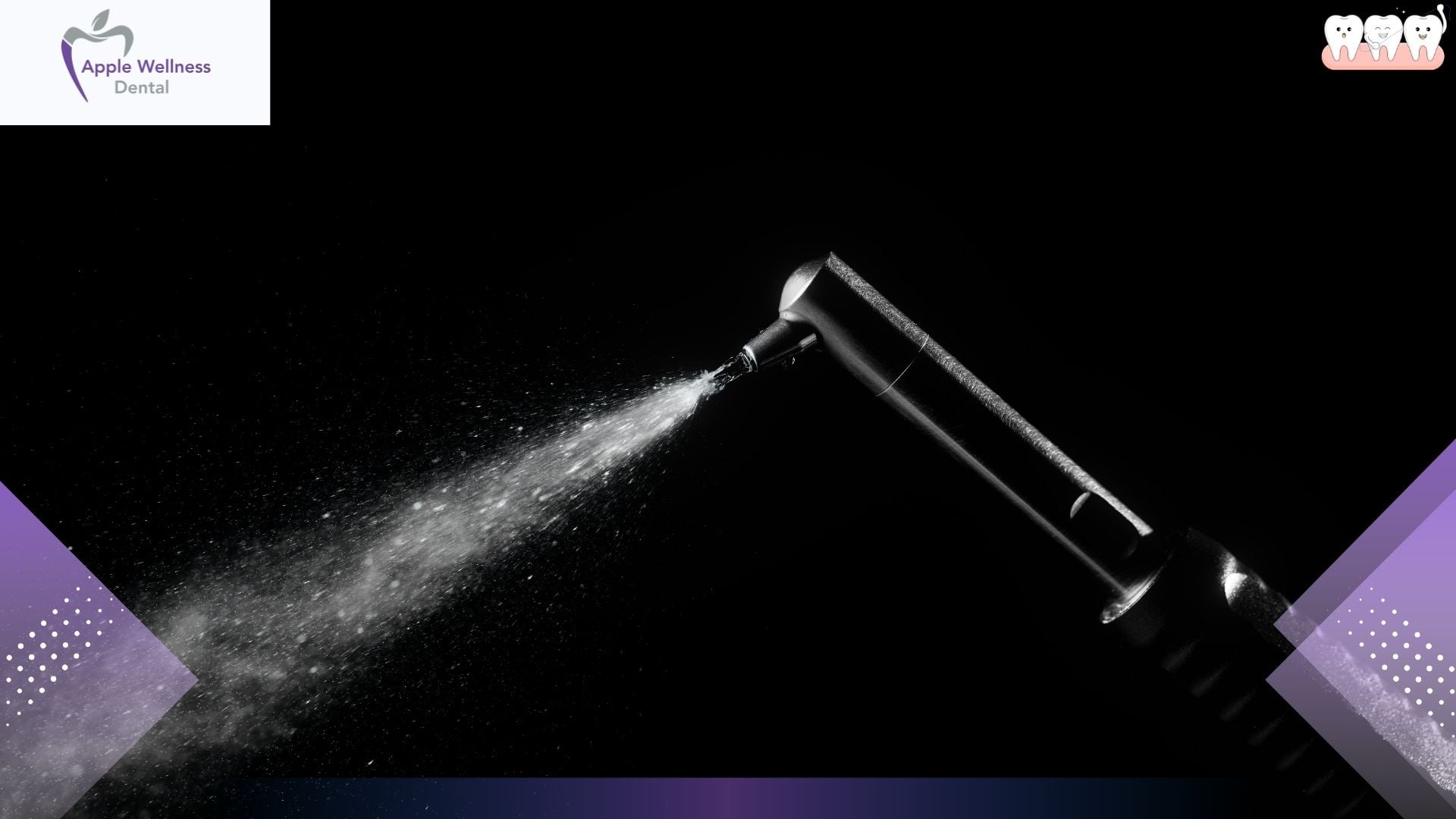 Understanding Air Abrasion Dentistry: The Comprehensive 2026 Guide to Drill-Free Treatments - Apple Wellness Dental