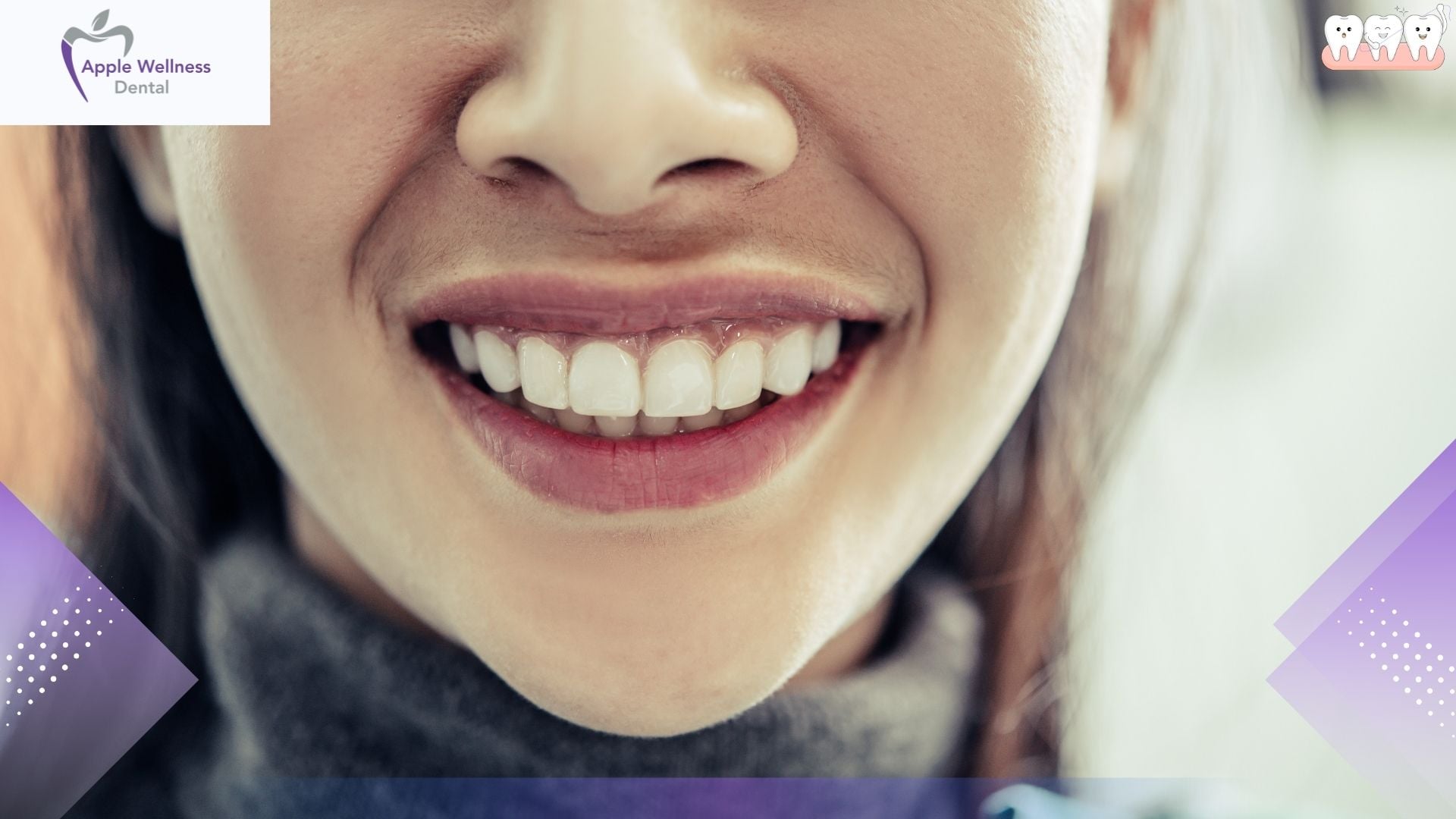 How to Correct an Uneven Smile: A Complete Guide to Facial Asymmetry - Apple Wellness Dental How to Correct an Uneven Smile: A Complete Guide to Facial Asymmetry - Apple Wellness Dental