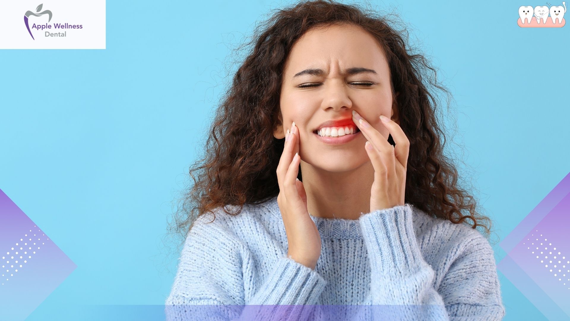 Gingivitis Healing Time: How Long Before Your Gums Recover? - Apple Wellness Dental Gingivitis Healing Time: How Long Before Your Gums Recover? - Apple Wellness Dental