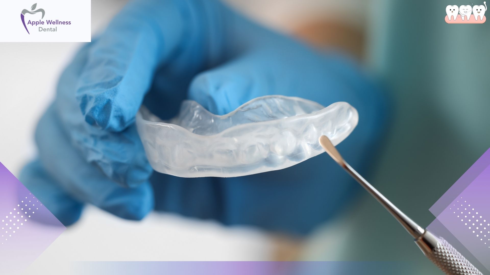 Understanding Dental Occlusal Adjustment: The Complete Guide to Bite Equilibration - Apple Wellness Dental