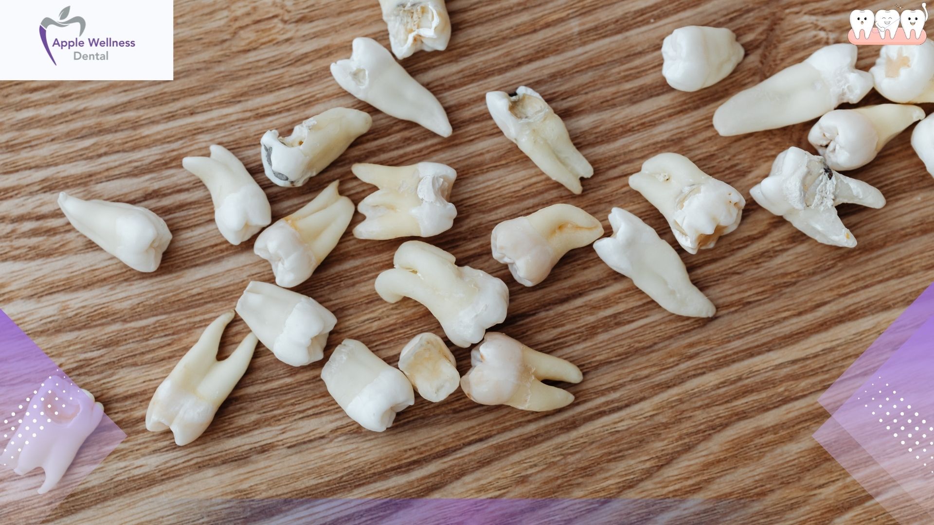 The Comprehensive 2026 Guide to Tooth Extraction Costs and Financial Planning - Apple Wellness Dental