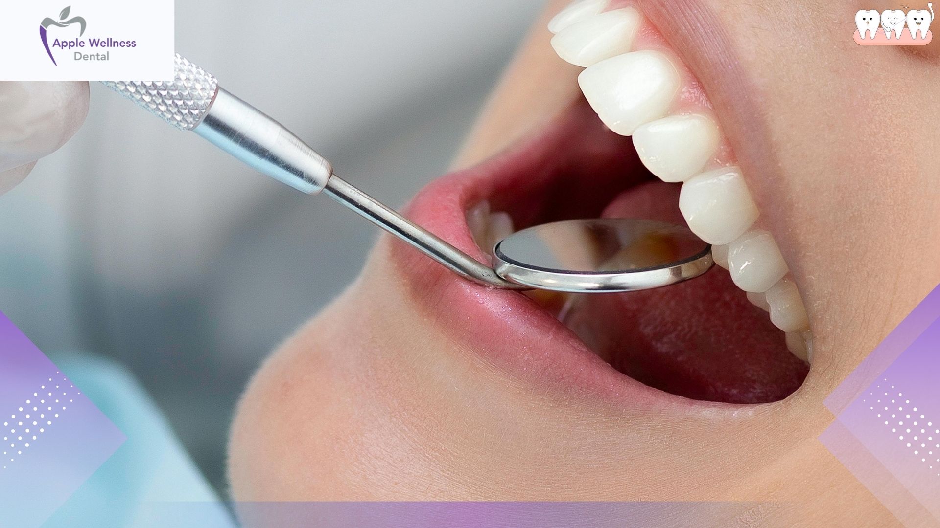 The Reality of Tooth Extraction Pain: A Comprehensive Guide to Procedure and Recovery - Apple Wellness Dental