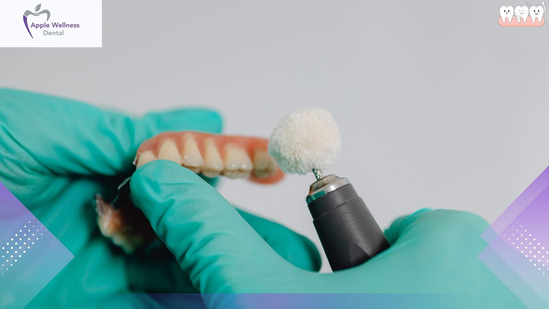 The Complete Guide to Fixed Dental Prostheses: Restoring Function and Aesthetics - Apple Wellness Dental