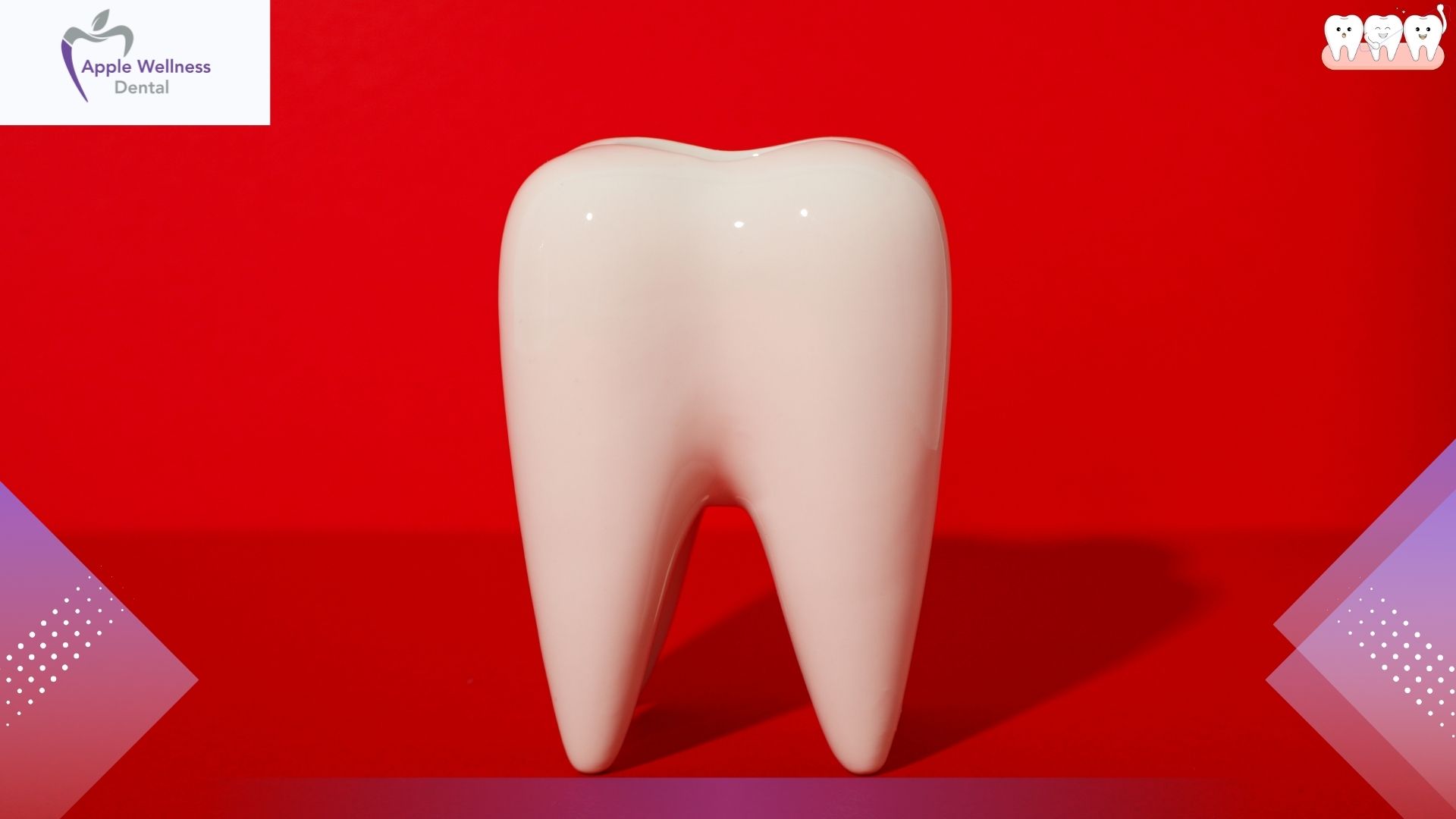 Understanding Adjacent Tooth Pain After Wisdom Teeth Removal - Apple Wellness Dental