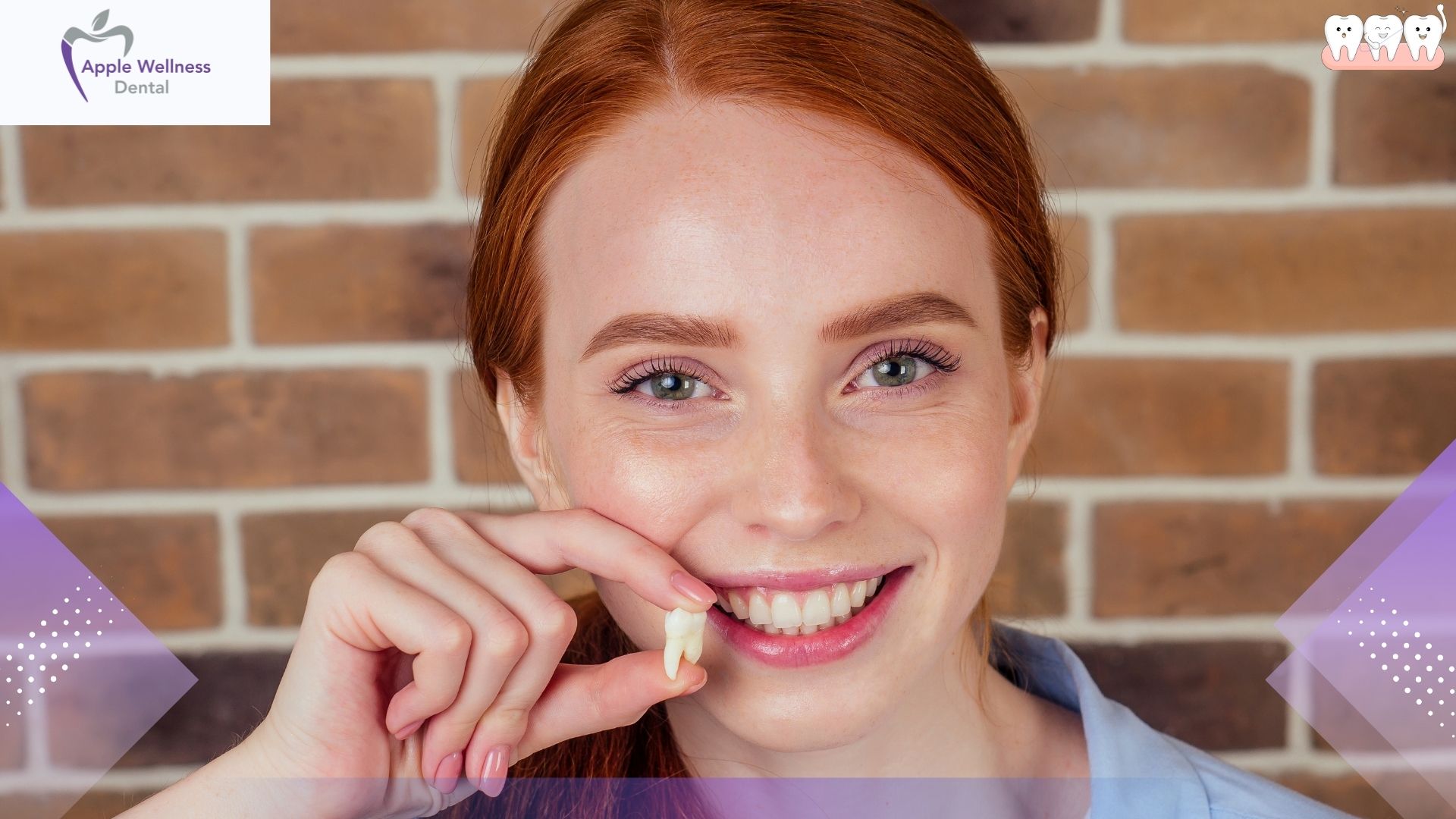 The Complete Patient Guide: Navigating Day 3 After Wisdom Teeth Removal - Apple Wellness Dental