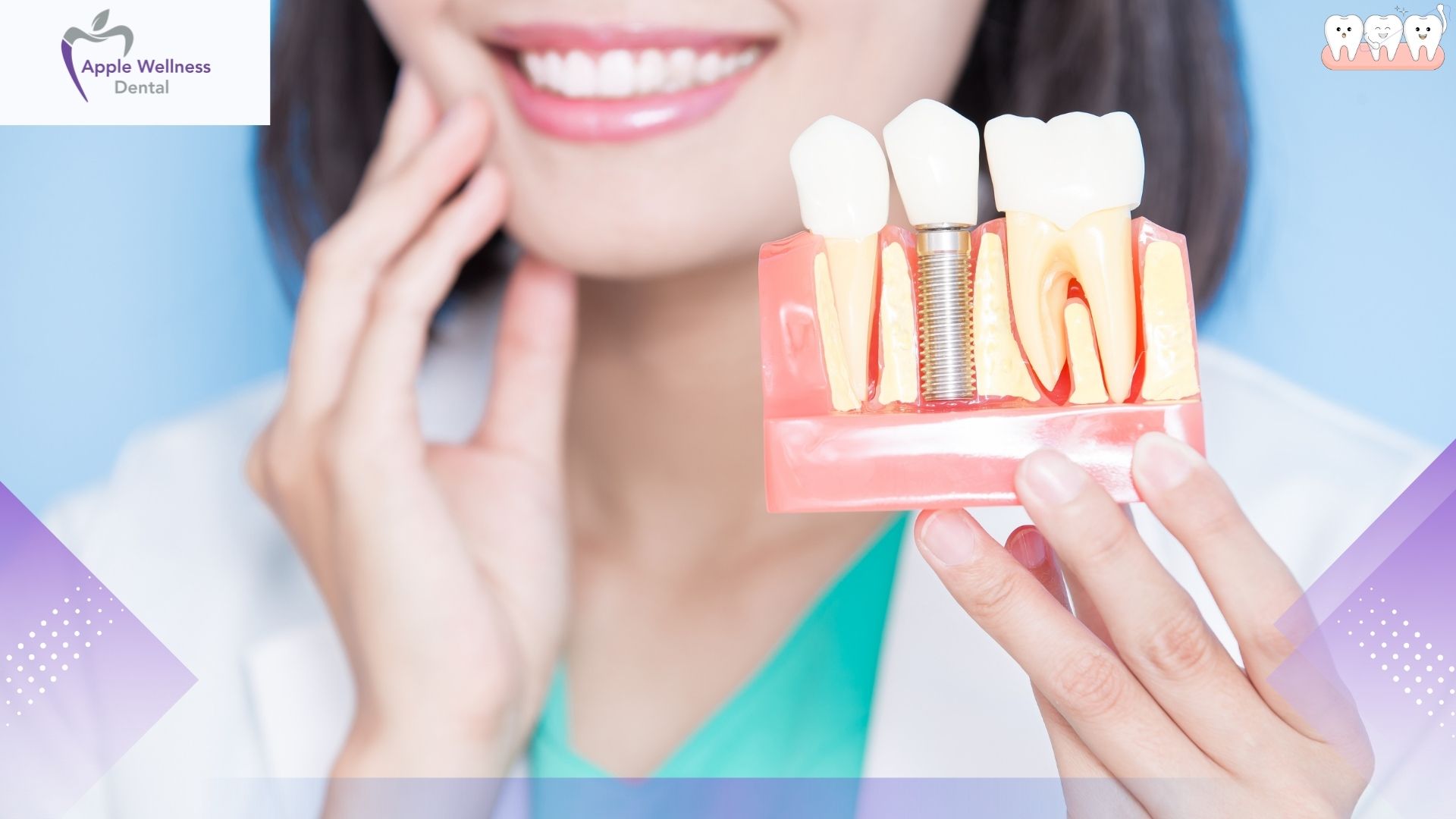 Smoking After Tooth Extraction: Timelines, Risks, and Healing Protocols - Apple Wellness Dental
