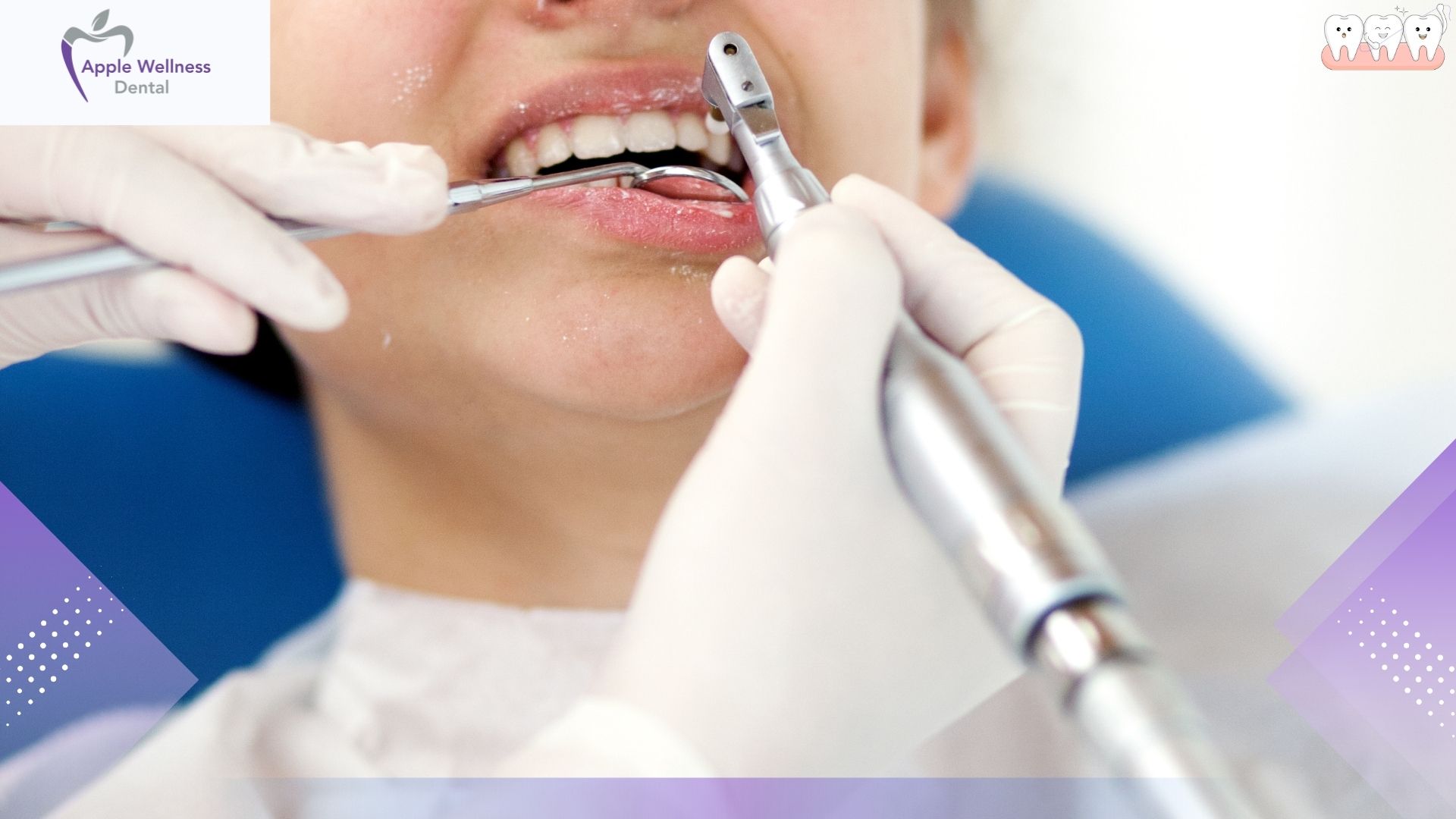 The Ultimate 2026 Guide to Mastering Your Water Flosser for Optimal Oral Health - Apple Wellness Dental
