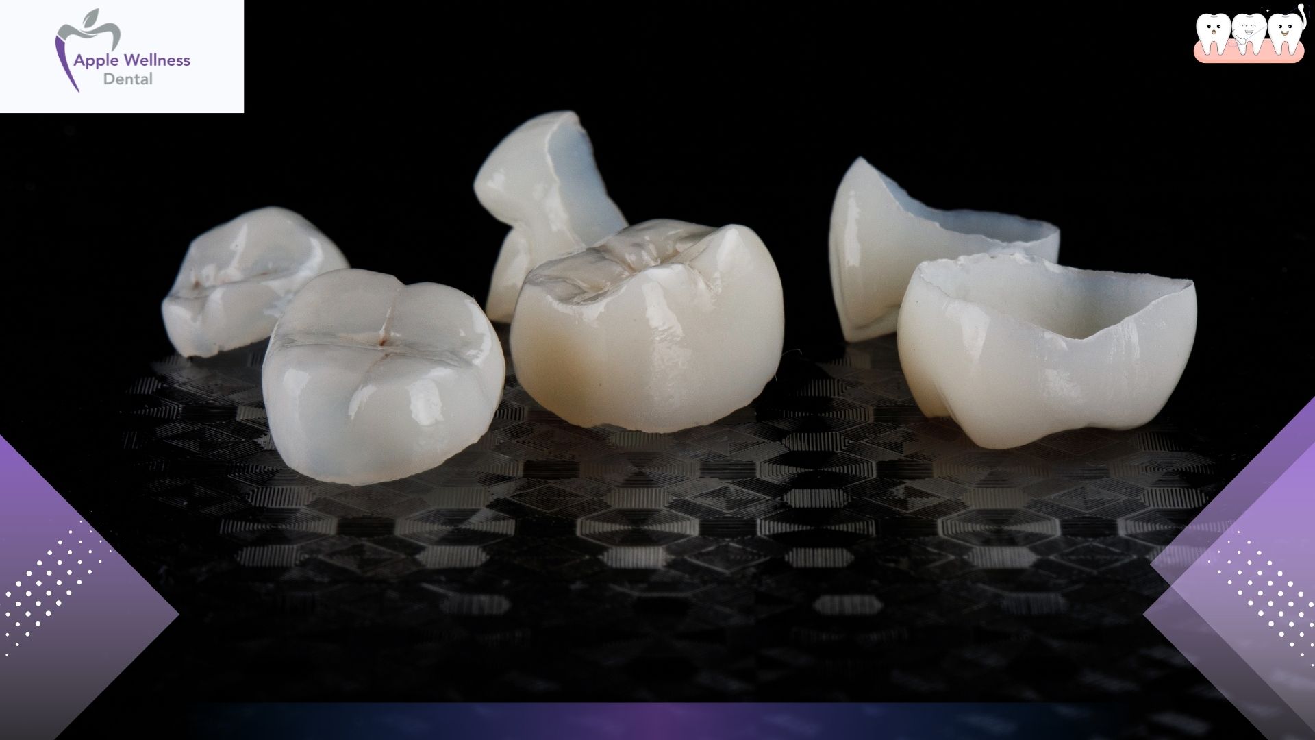 The Complete Guide to the Porcelain Manufacturing Process: From Raw Clay to Fired Masterpiece - Apple Wellness Dental