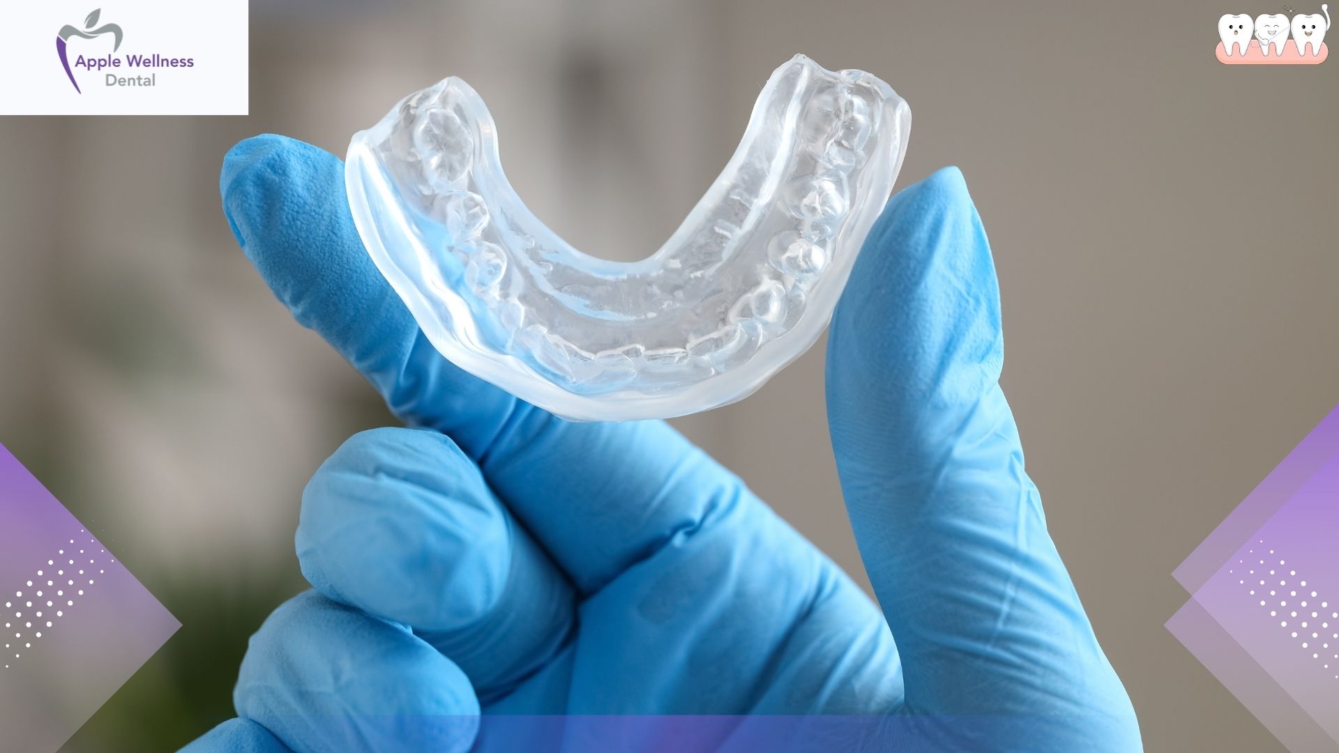 Understanding Dental Occlusal Adjustment: The Complete Guide to Bite Equilibration - Apple Wellness Dental
