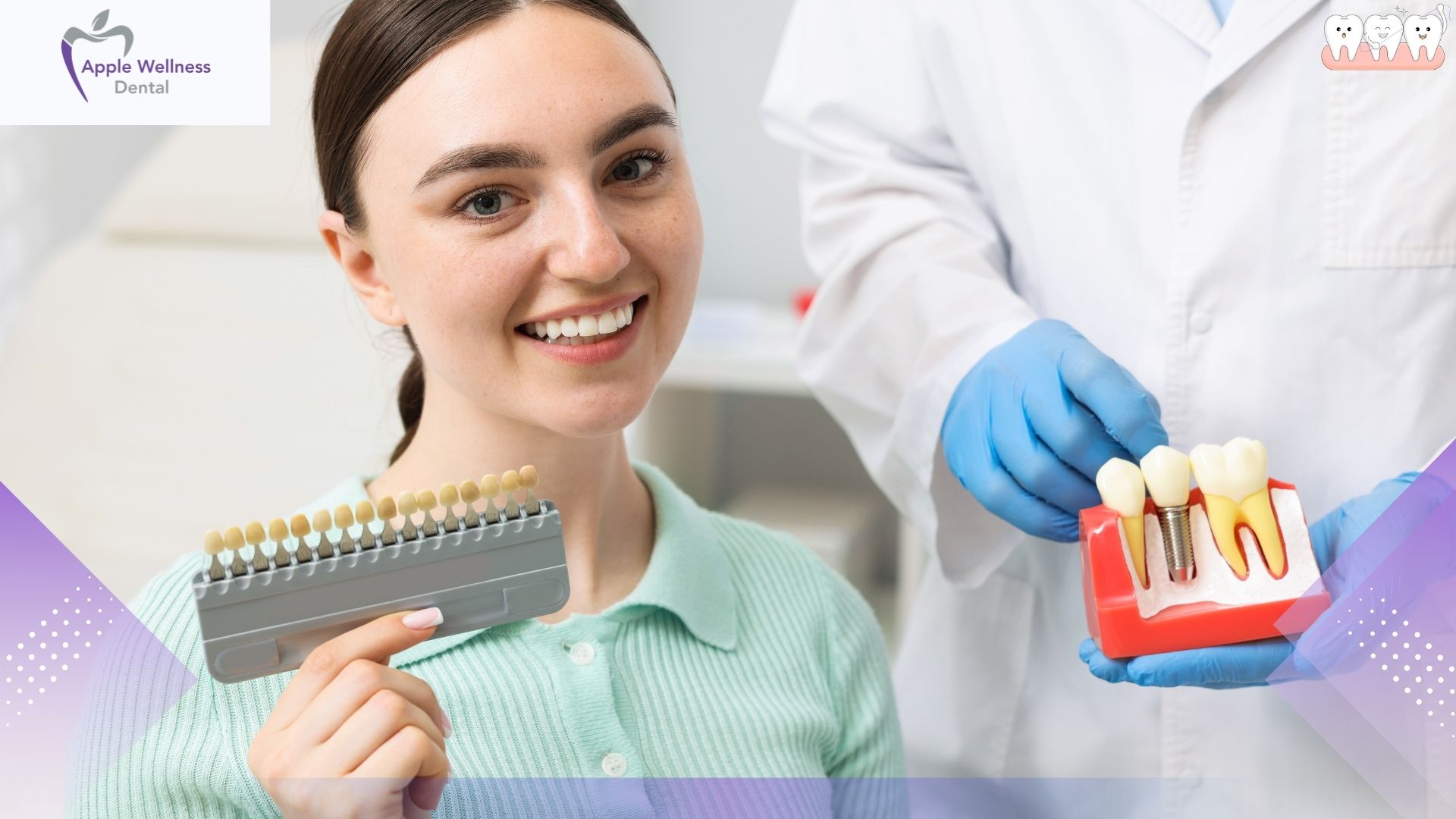 The Complete Guide to Veneer Lifespans: Durability, Care, and Replacement in 2026 - Apple Wellness Dental