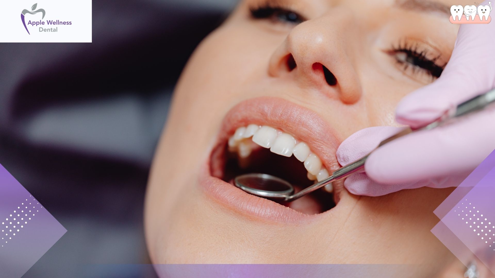 Oral Care Post-Extraction: Safe Mouthwash Practices on Day Four - Apple Wellness Dental
