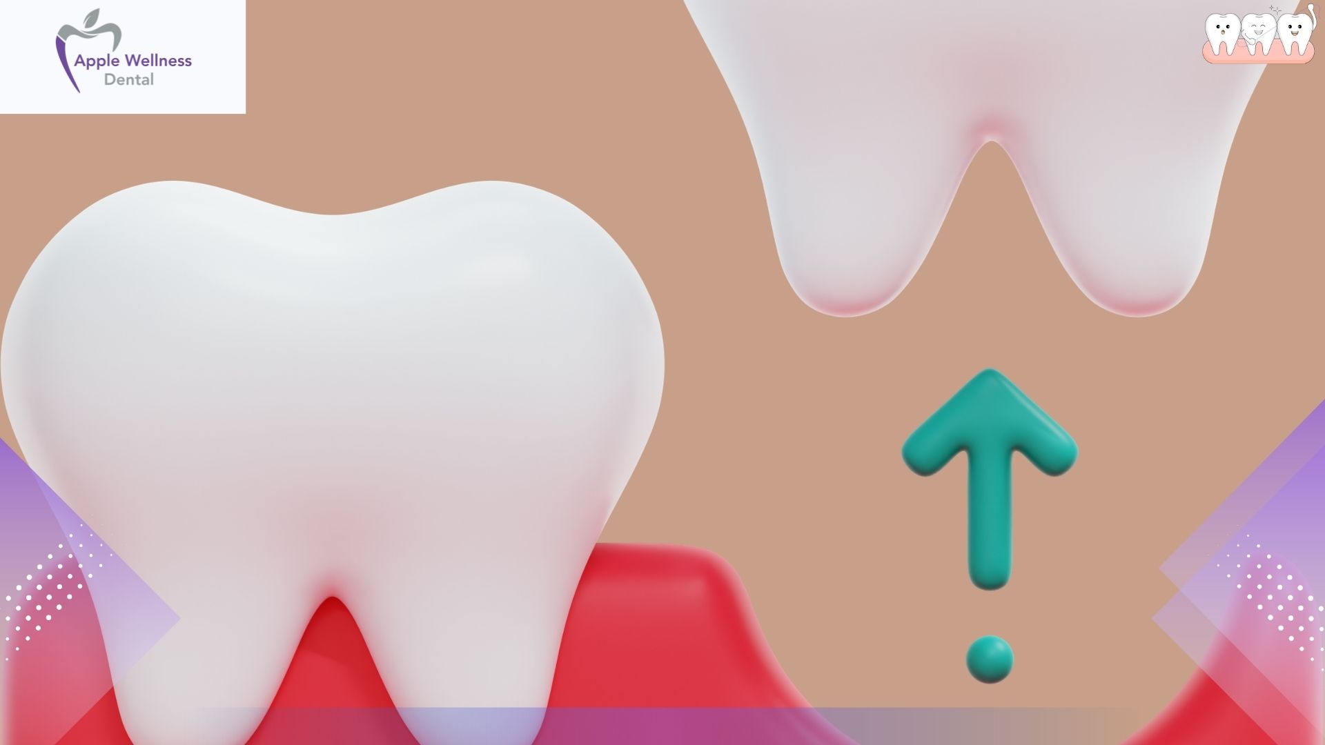 The Comprehensive 2026 Guide to Tooth Extraction Costs and Financial Planning - Apple Wellness Dental