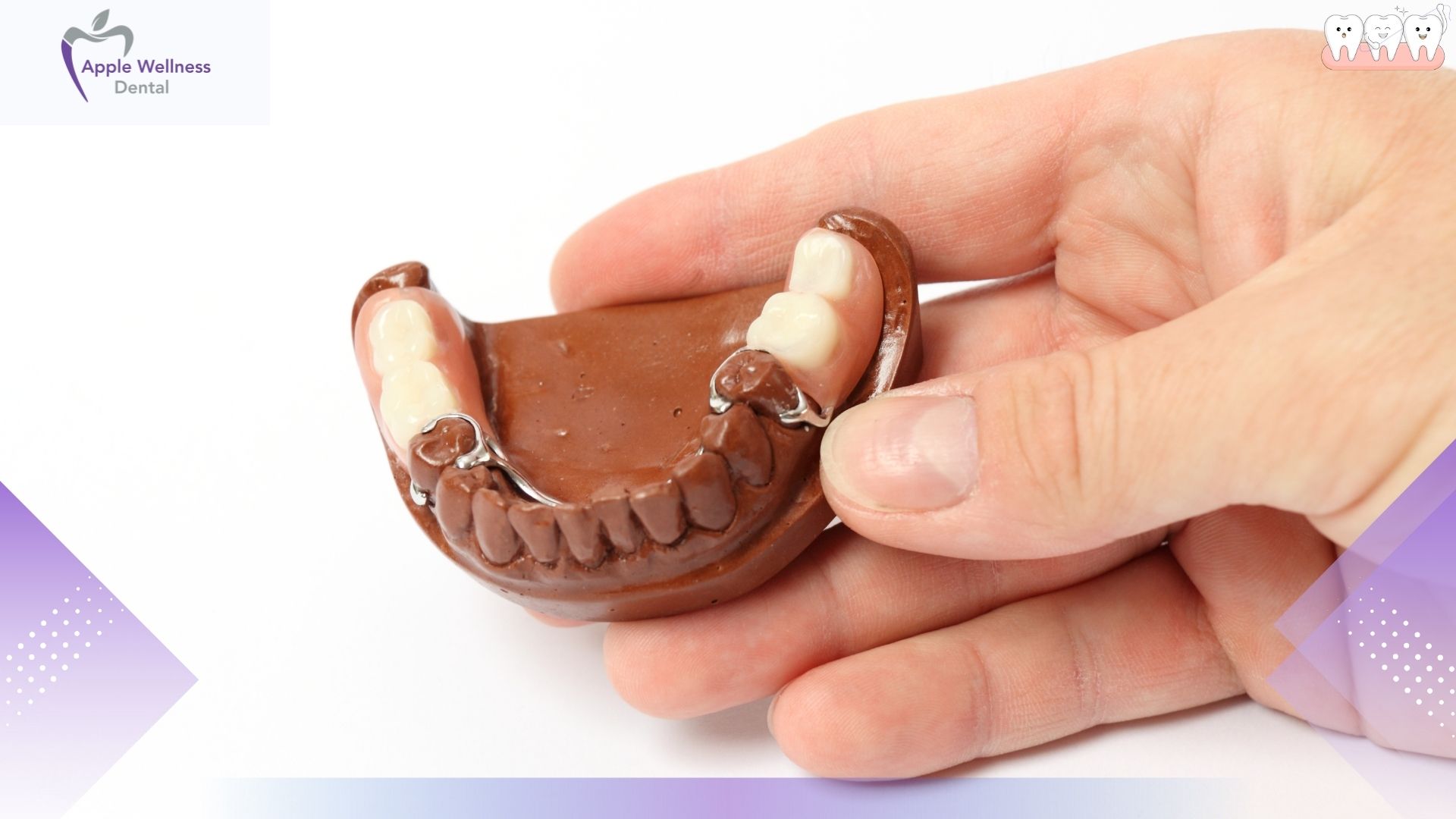 The Complete 2026 Guide to Porcelain Crown Costs and Insurance Coverage - Apple Wellness Dental