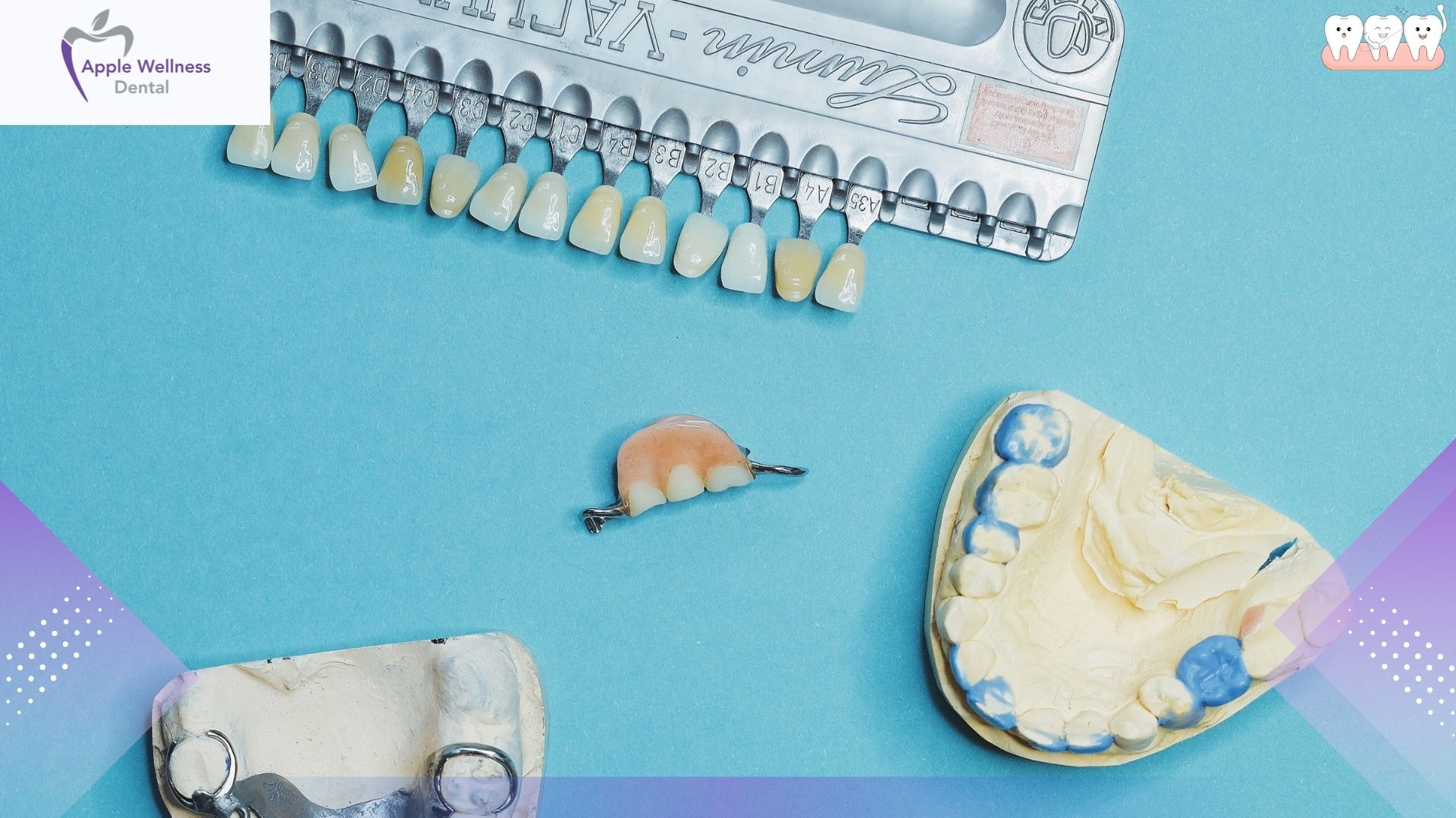 A Complete Guide to Dental Veneers: Costs, Types, and Procedures in 2026 - Apple Wellness Dental