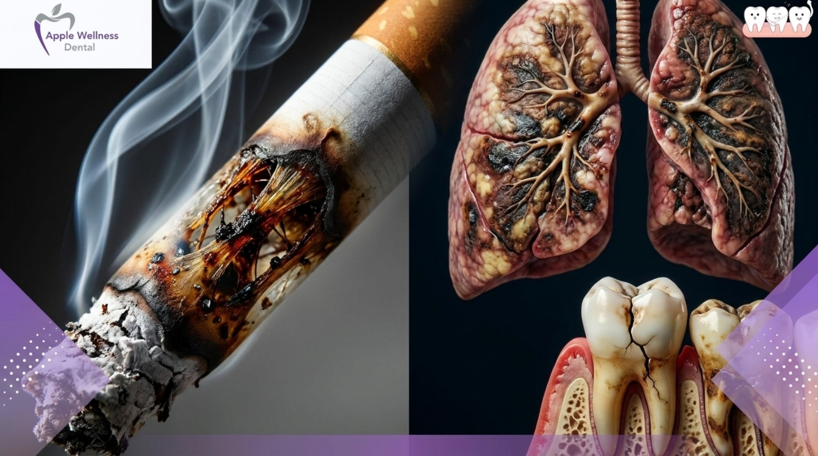 Healing Safely: The Complete Guide to Smoking After Tooth Extraction - Apple Wellness Dental