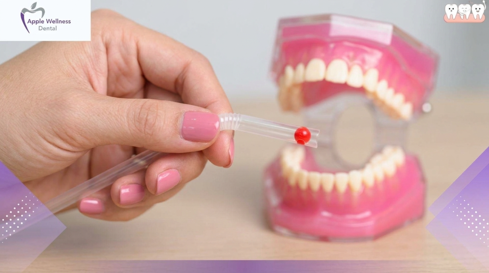 The Complete 2026 Guide: Healing Timelines and Post-Extraction Care - Apple Wellness Dental