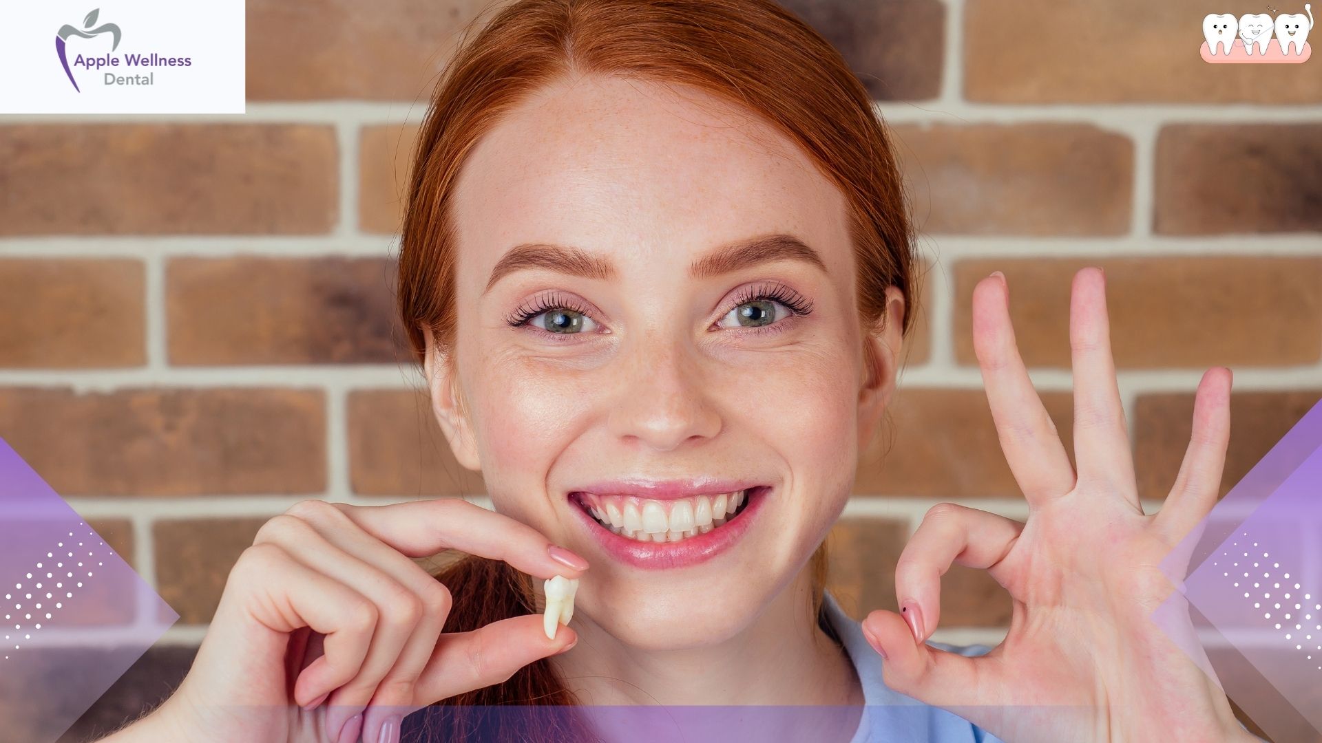 How Long Should I Take Painkillers After Wisdom Tooth Extraction? - Apple Wellness Dental